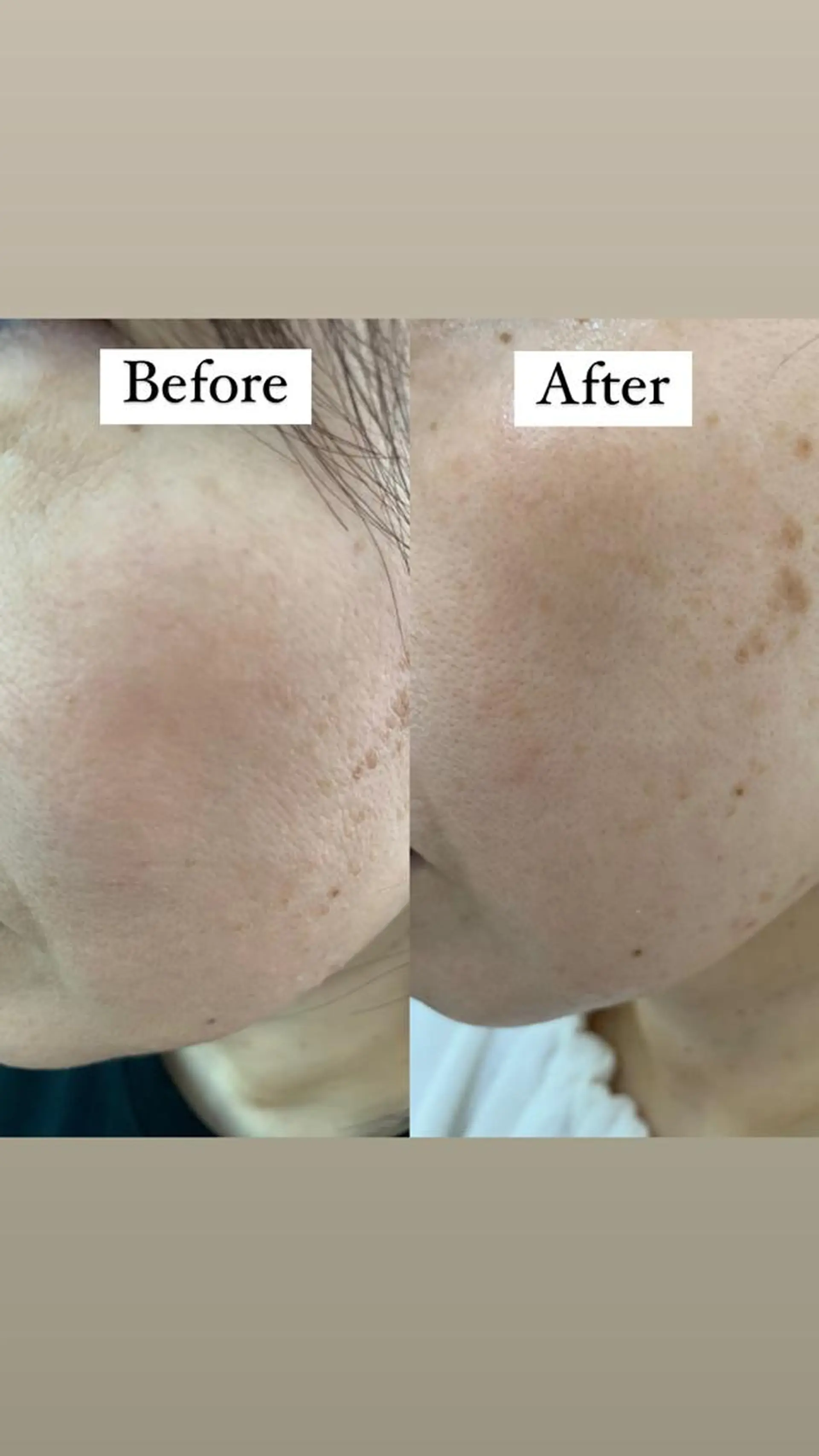 デ・アイム新潟　　北所属・山口 萌のエステ・リラクイメージ