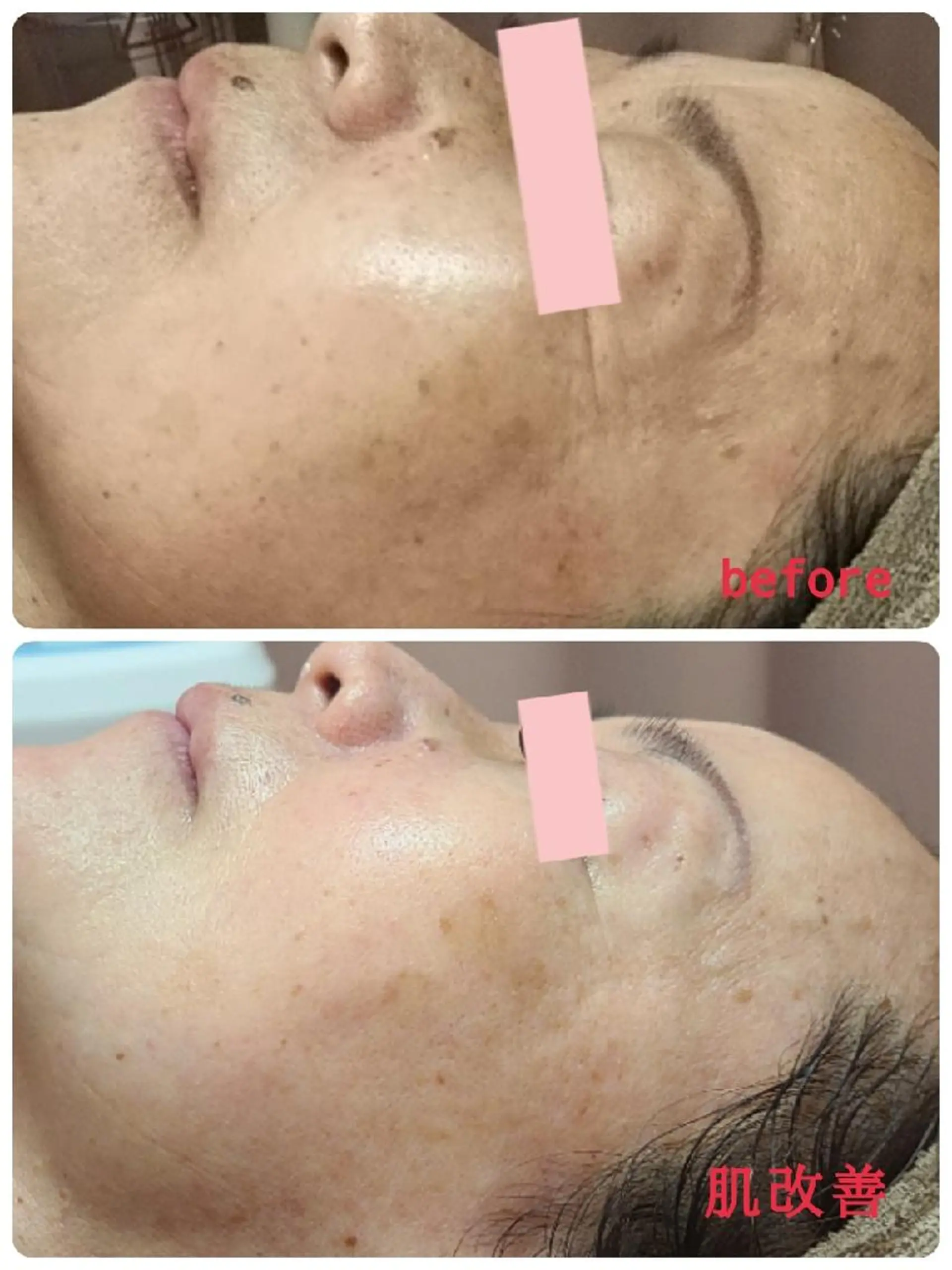 小顔と美肌 まごころエステMatoria所属・小顔 美肌専門 Matoriaのエステ・リラクイメージ