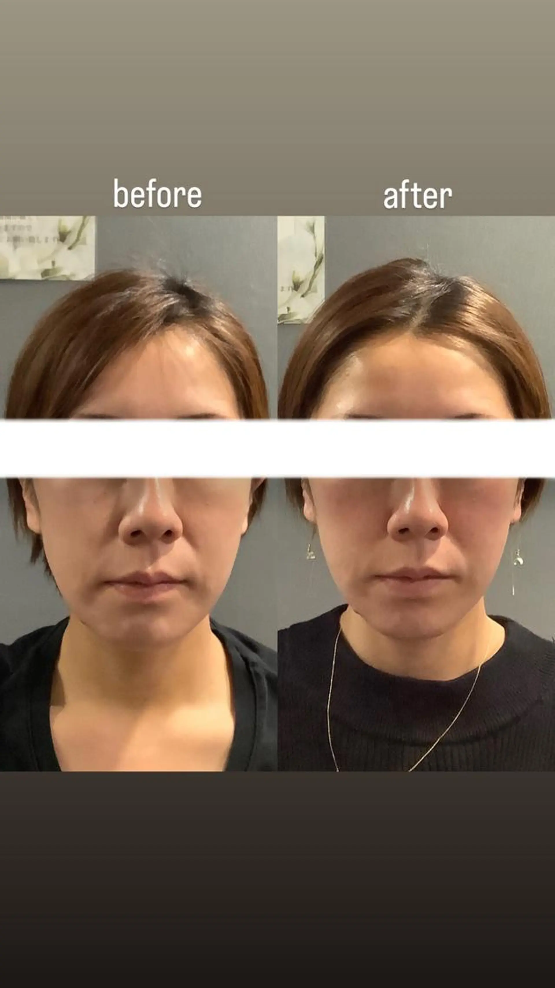 エステ リラク エステサロンino.colore'所属・小顔サロン ino.coloreのエステ・リラクイメージ