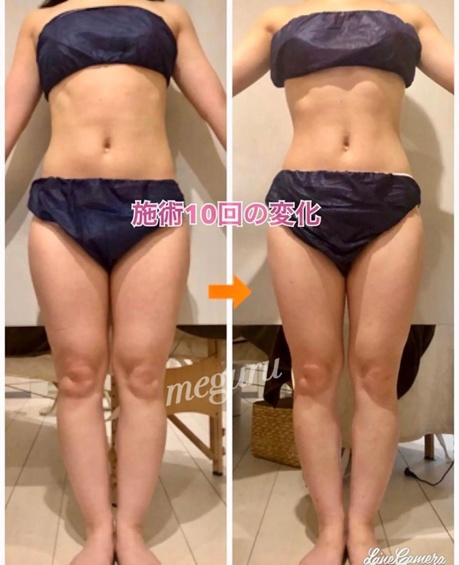 ショート カラー パーマ ヘアアレンジ メンズ キッズ ネイル マツエク・マツパ エステ リラク ‍痩身＆ボディ 結果出し🌟丹野のエステ・リラクイメージ