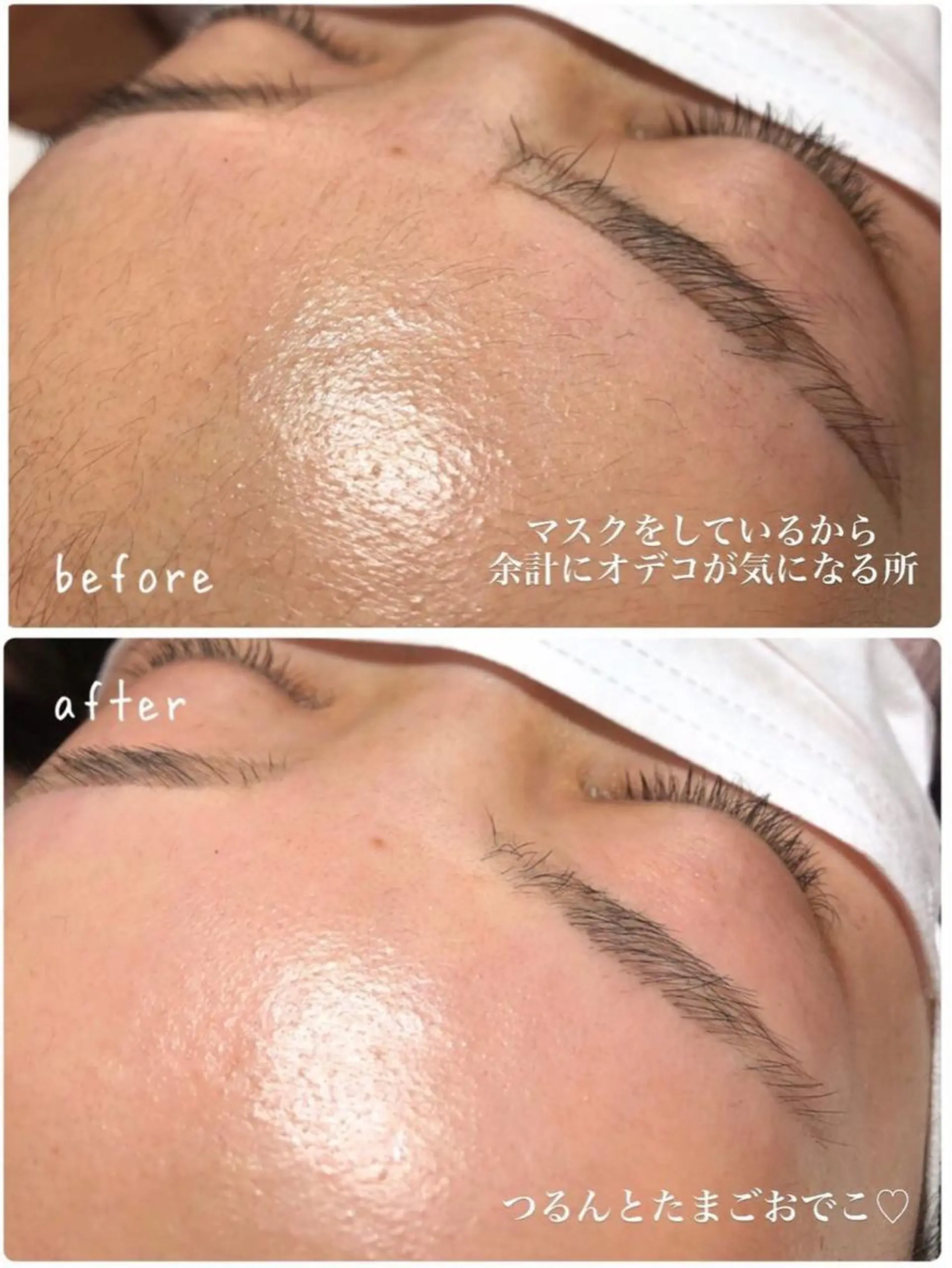 アイブロウ 眉毛ワックス脱毛 OHAKO塚田 可奈子のその他イメージ