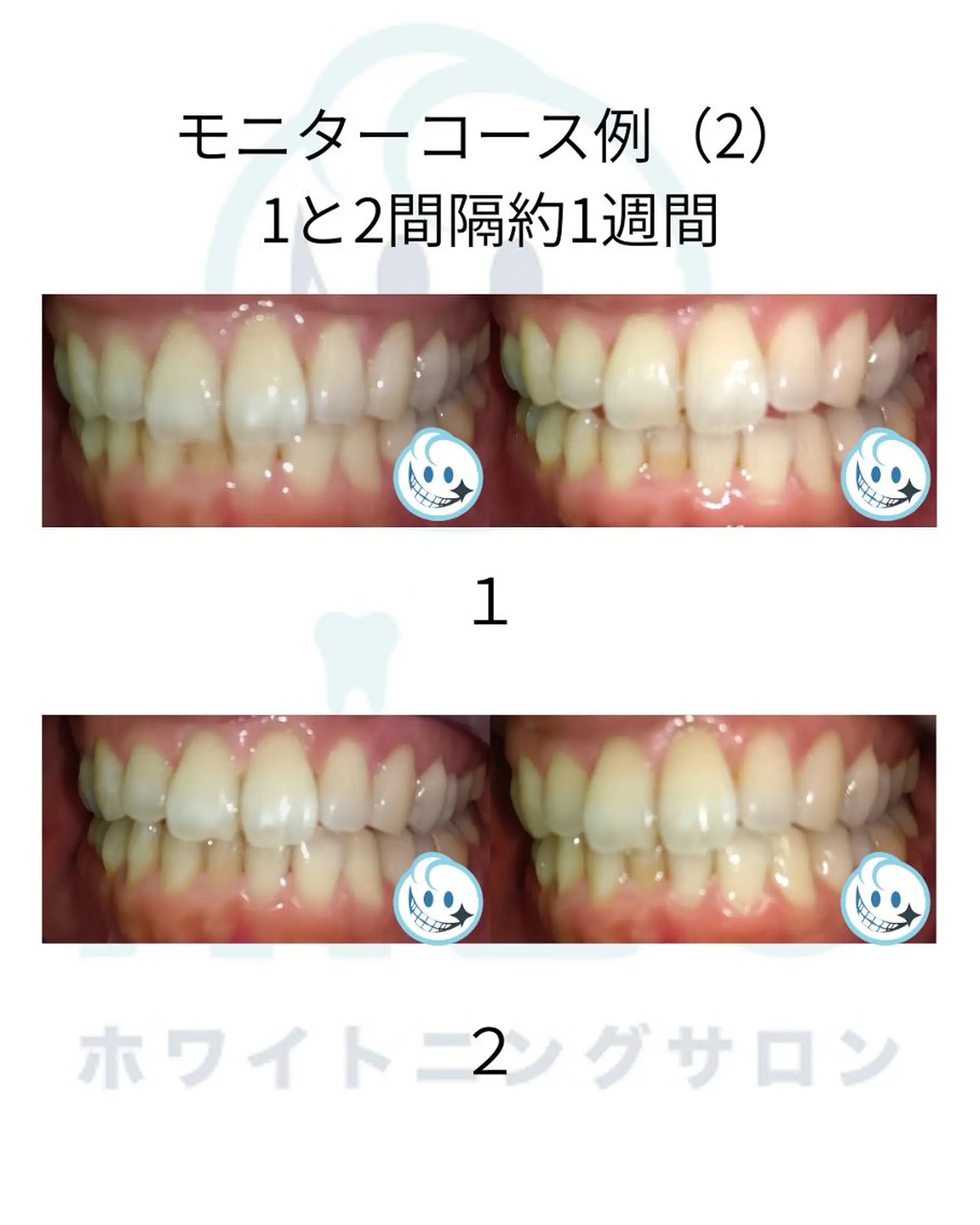 その他 ホワイトニングサロン nico西葛西店のその他イメージ