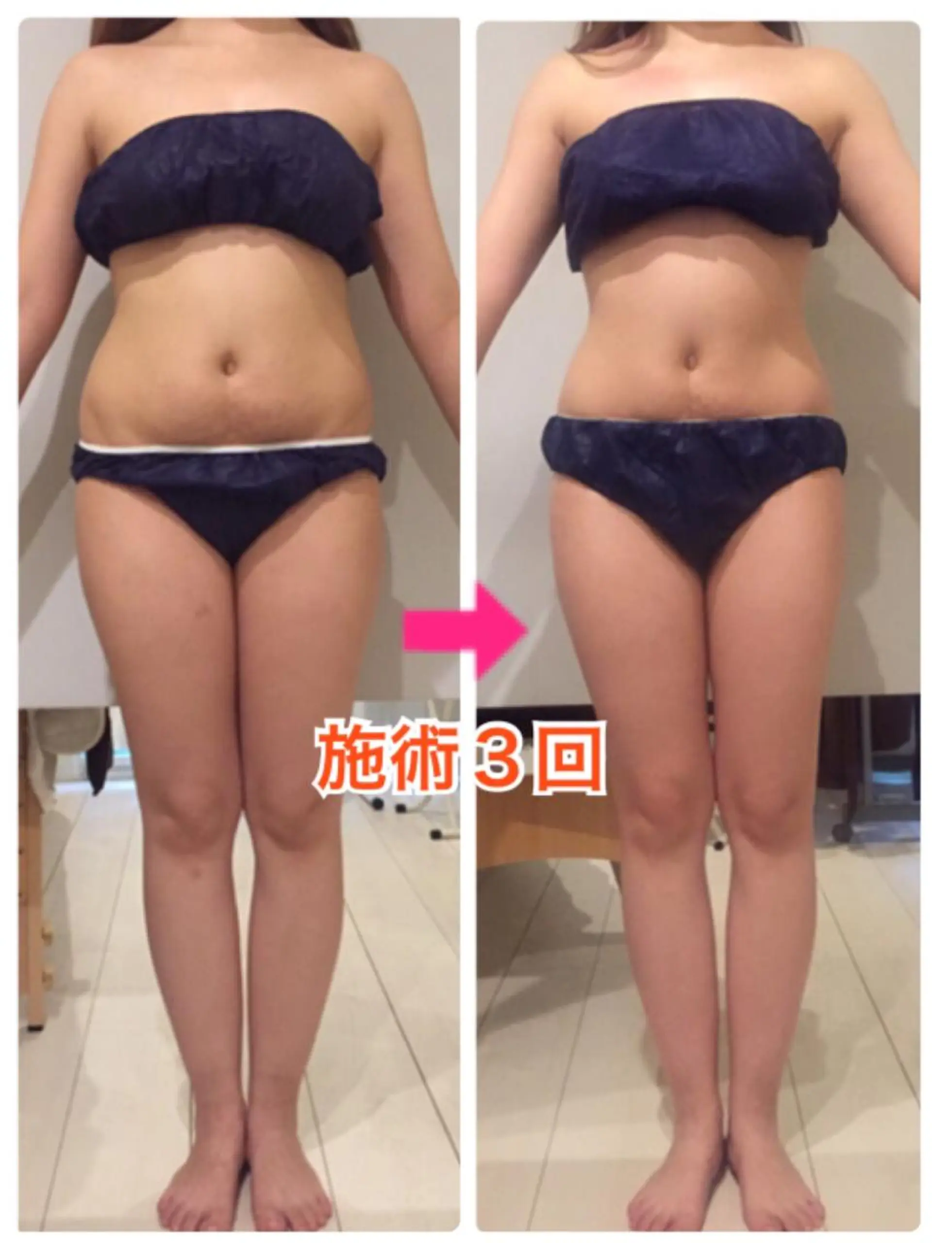 ショート カラー パーマ ヘアアレンジ メンズ キッズ ネイル マツエク・マツパ ‍痩身＆ボディ 結果出し🌟丹野のエステ・リラクイメージ