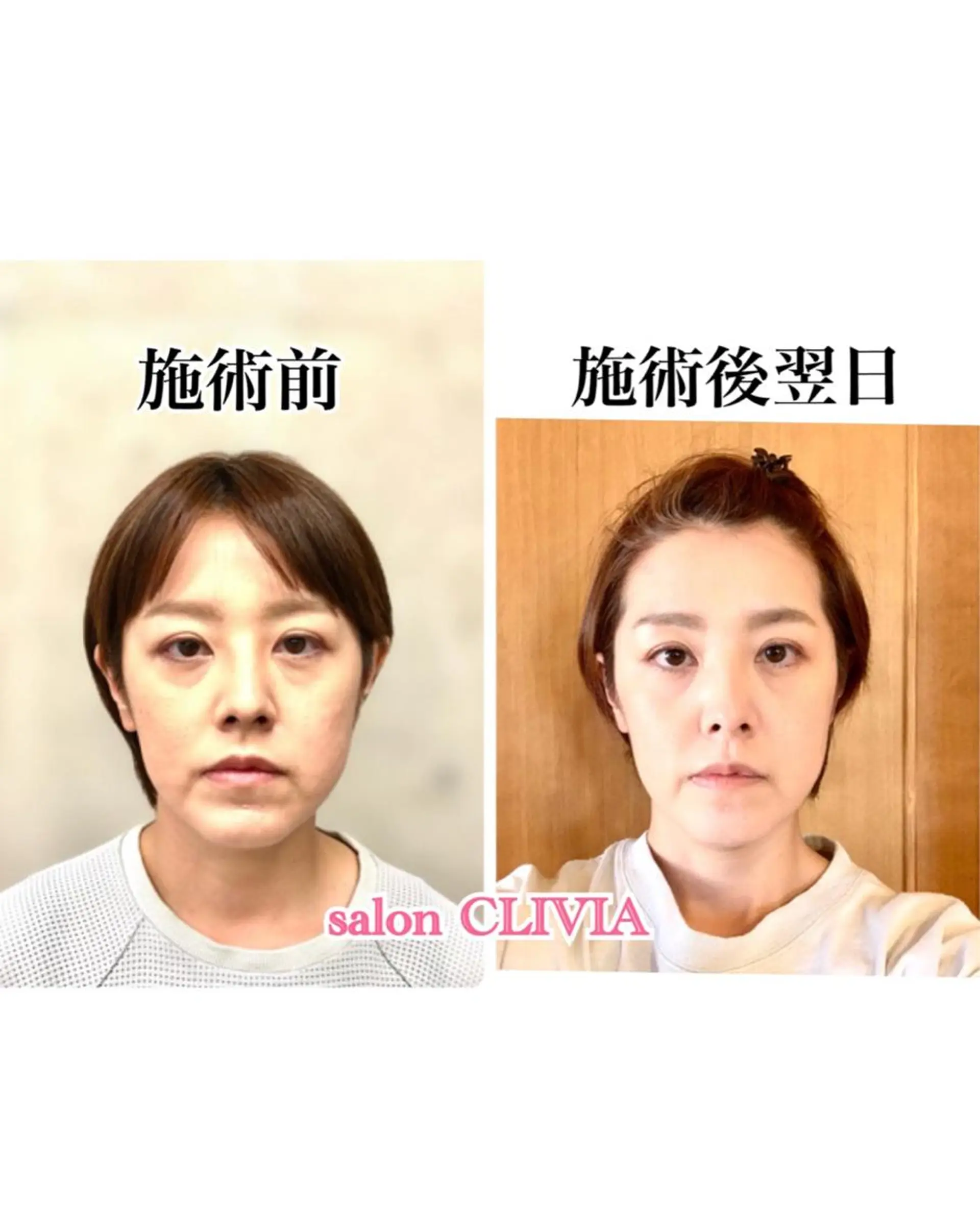 salon CLIVIA, クリヴィア所属・無痛小顔矯正 クリヴィアのエステ・リラクイメージ