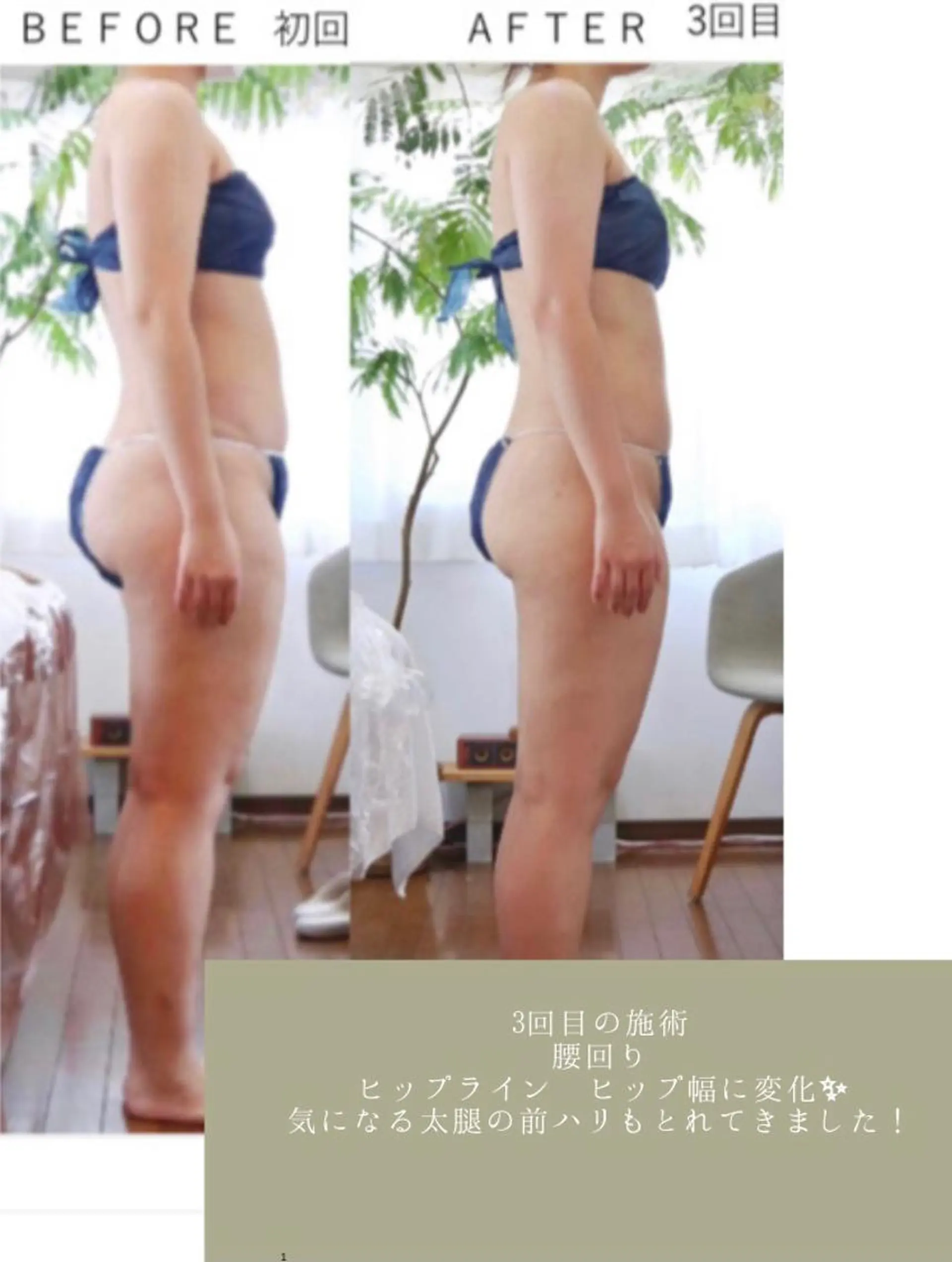 エステ リラク RENsalon大阪 体質改善リトリートのエステ・リラクイメージ