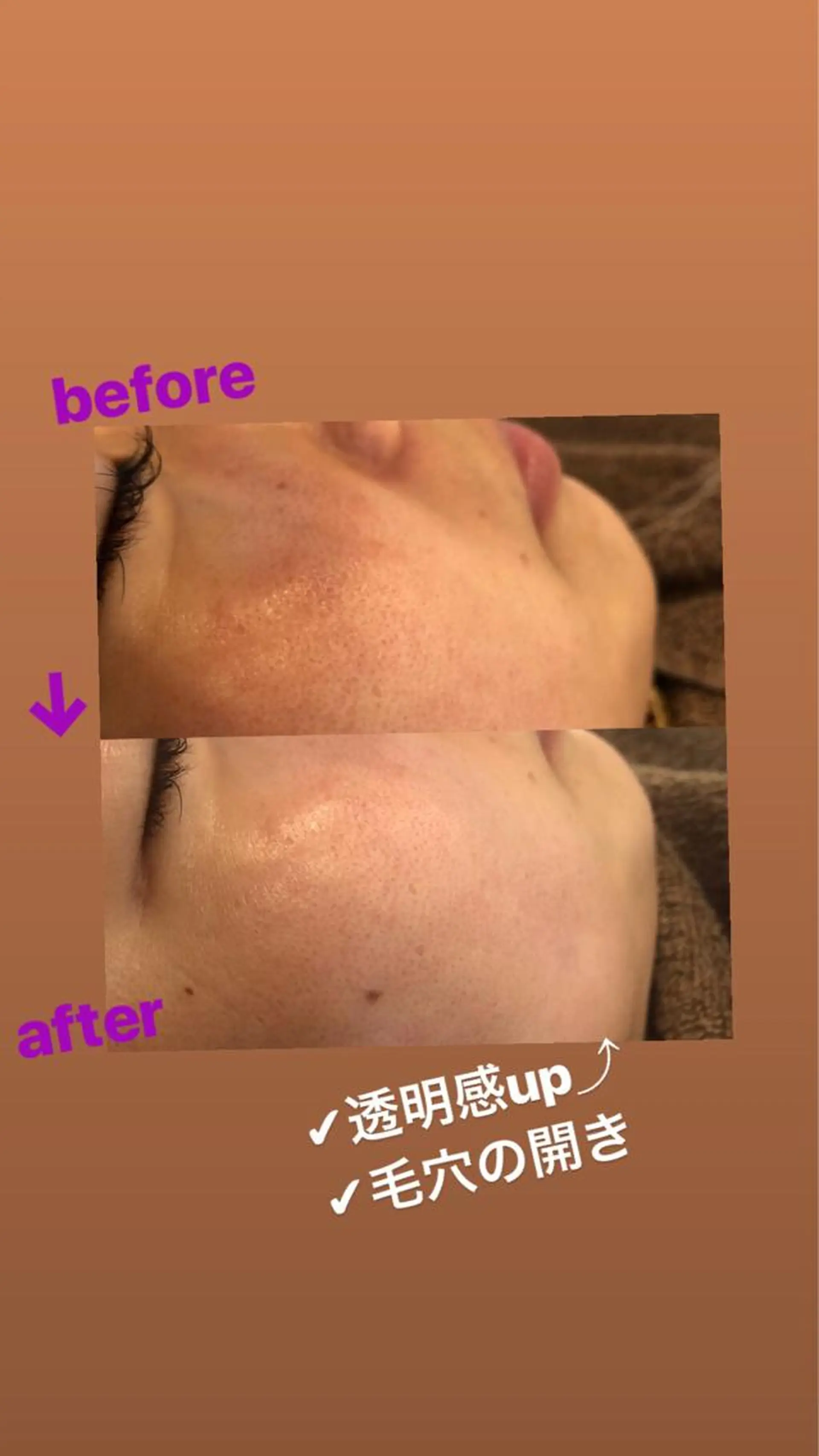 美容鍼・鍼灸専門❤✨ 近藤めぐみのエステ・リラクイメージ