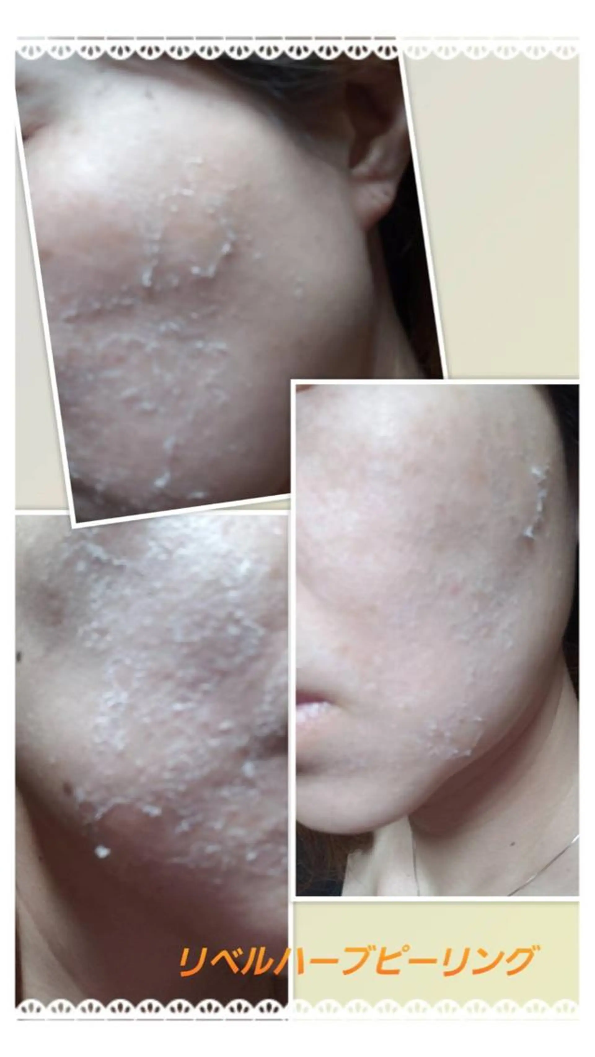 エステ Dione八王子店所属・LUKE （ルーク）のエステ・リラクイメージ