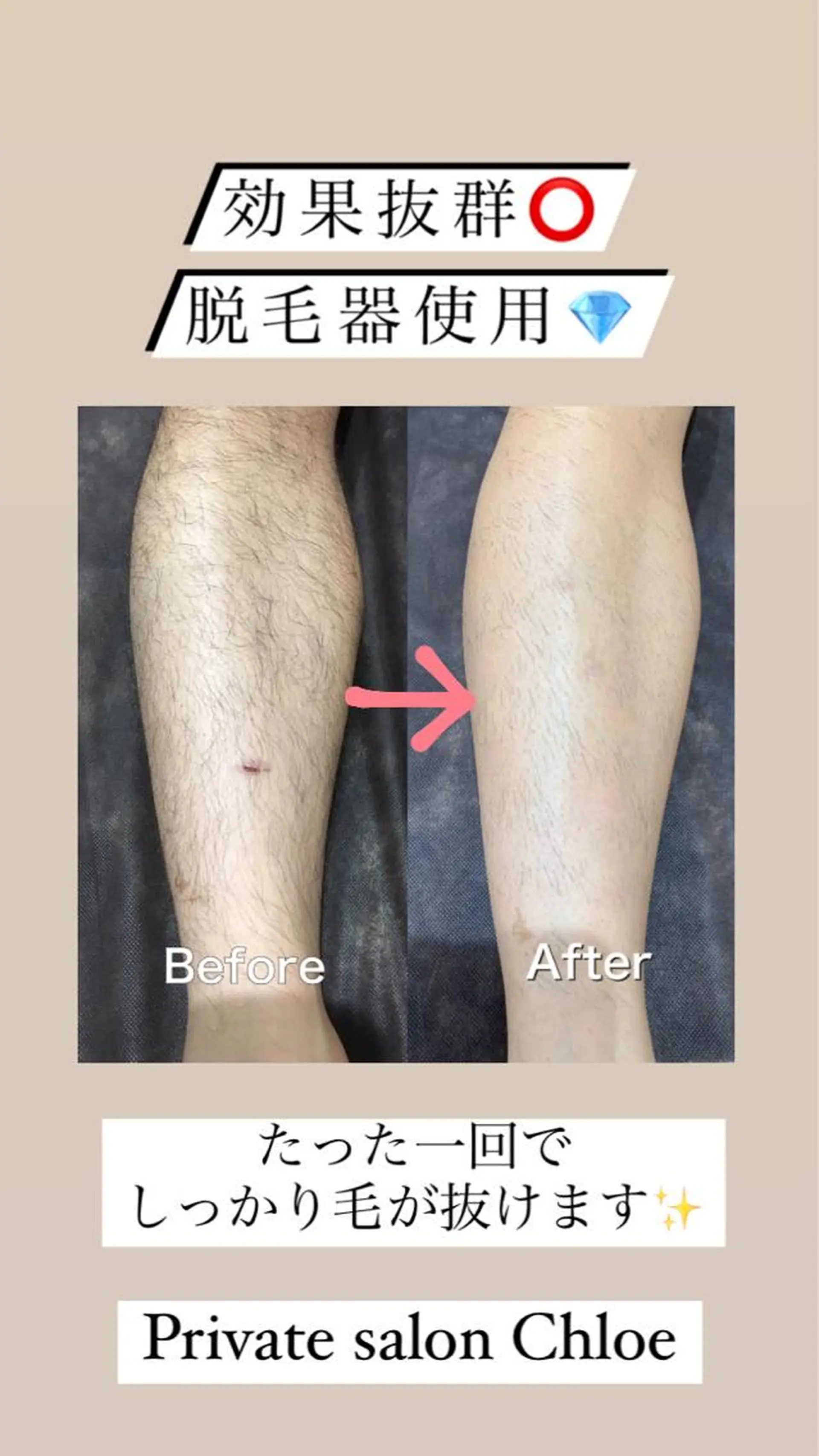 ミディアム カラー パーマ ヘアアレンジ メンズ キッズ ネイル マツエク・マツパ アイブロウ Chloe-クロエ- 脱毛/フェイシャルのエステ・リラクイメージ