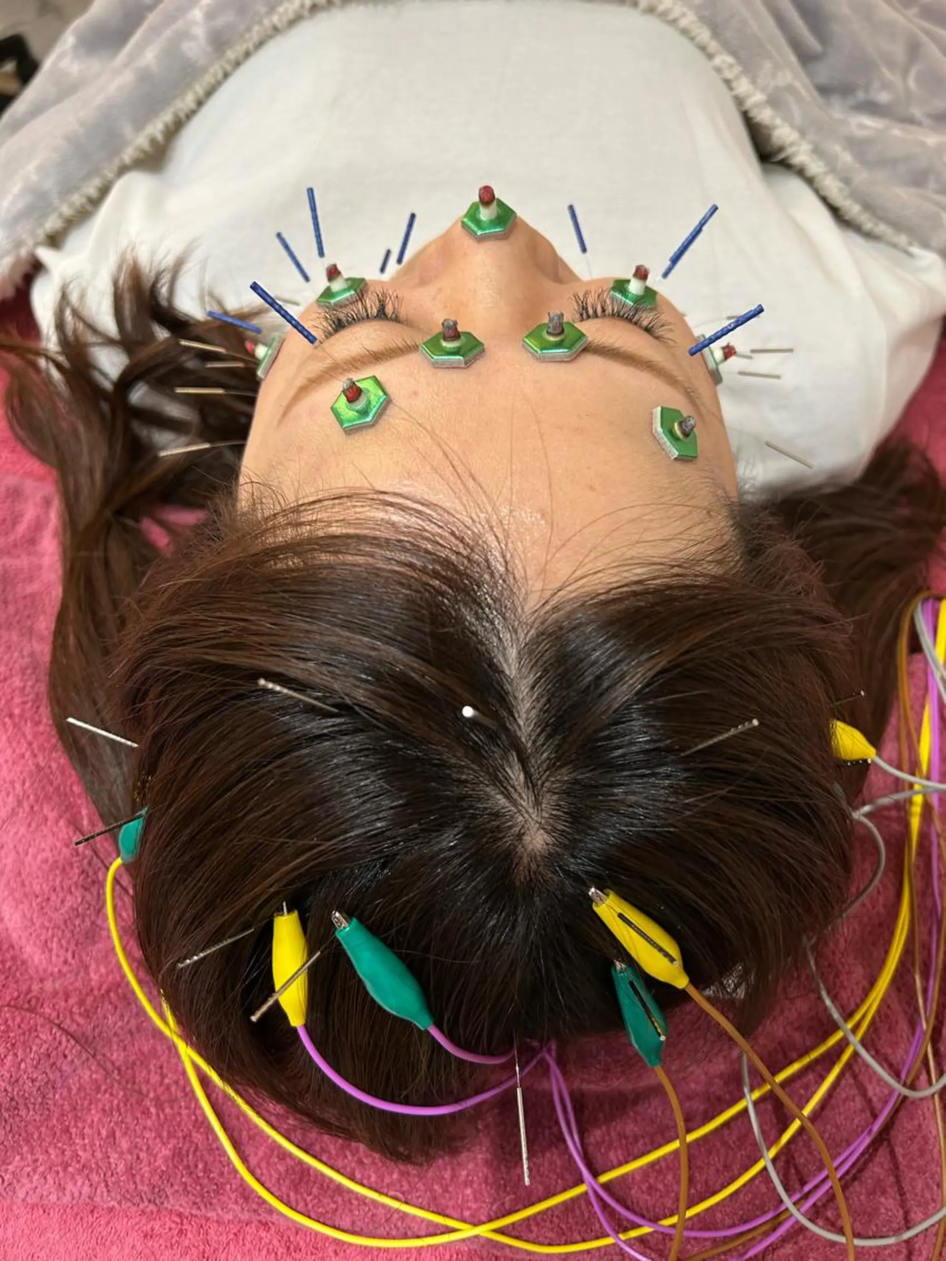 エステ リラク 美容鍼灸女性専用 りんご鍼灸治療院のその他イメージ