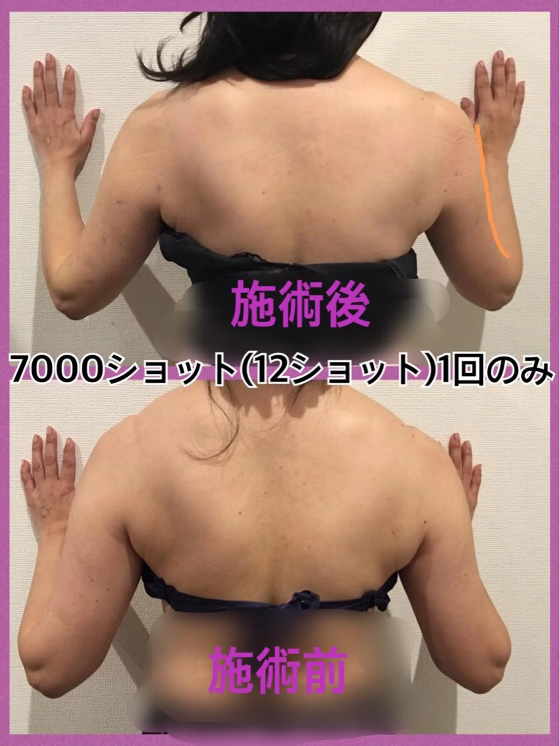 骨盤ダイエット痩身エステサロンBloom所属・坂田 真紀のエステ・リラクイメージ