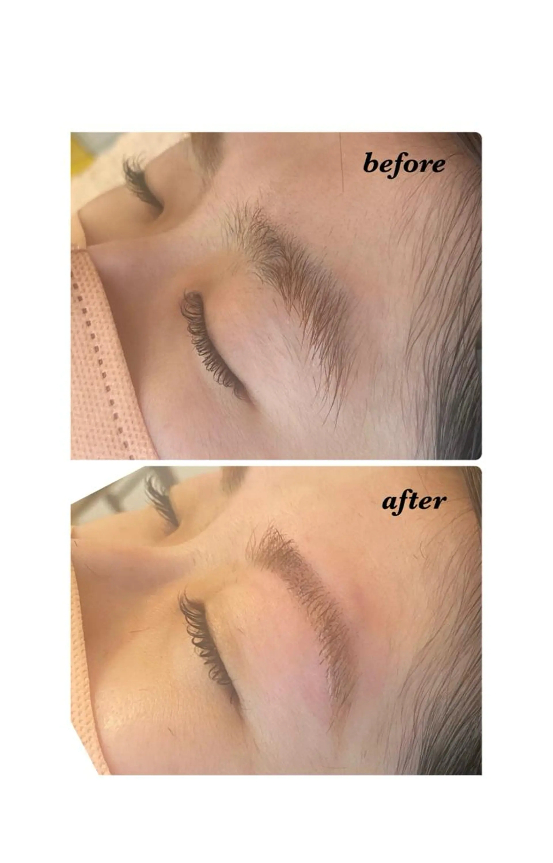 アイブロウ ハーブピーリング/韓国肌管理/フェイシャル/毛穴洗浄/眉毛/顔脱毛【糸脱毛専門】rev所属・ハーブピーリング🌹 毛穴洗浄❤️眉waxのエステ・リラクイメージ