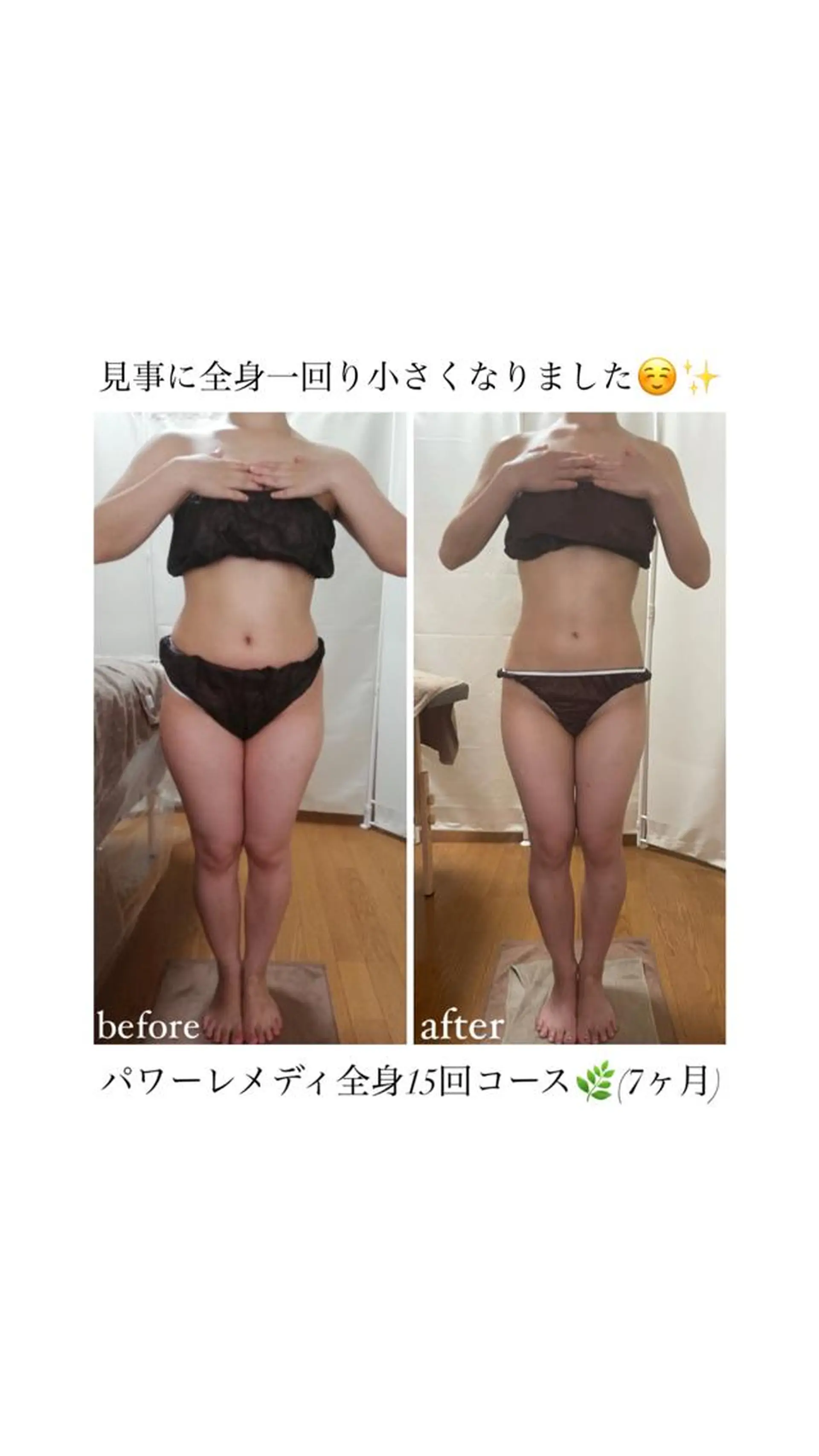 biloop所属・《本気痩せ×疲労改善 》  BILOOPのエステ・リラクイメージ