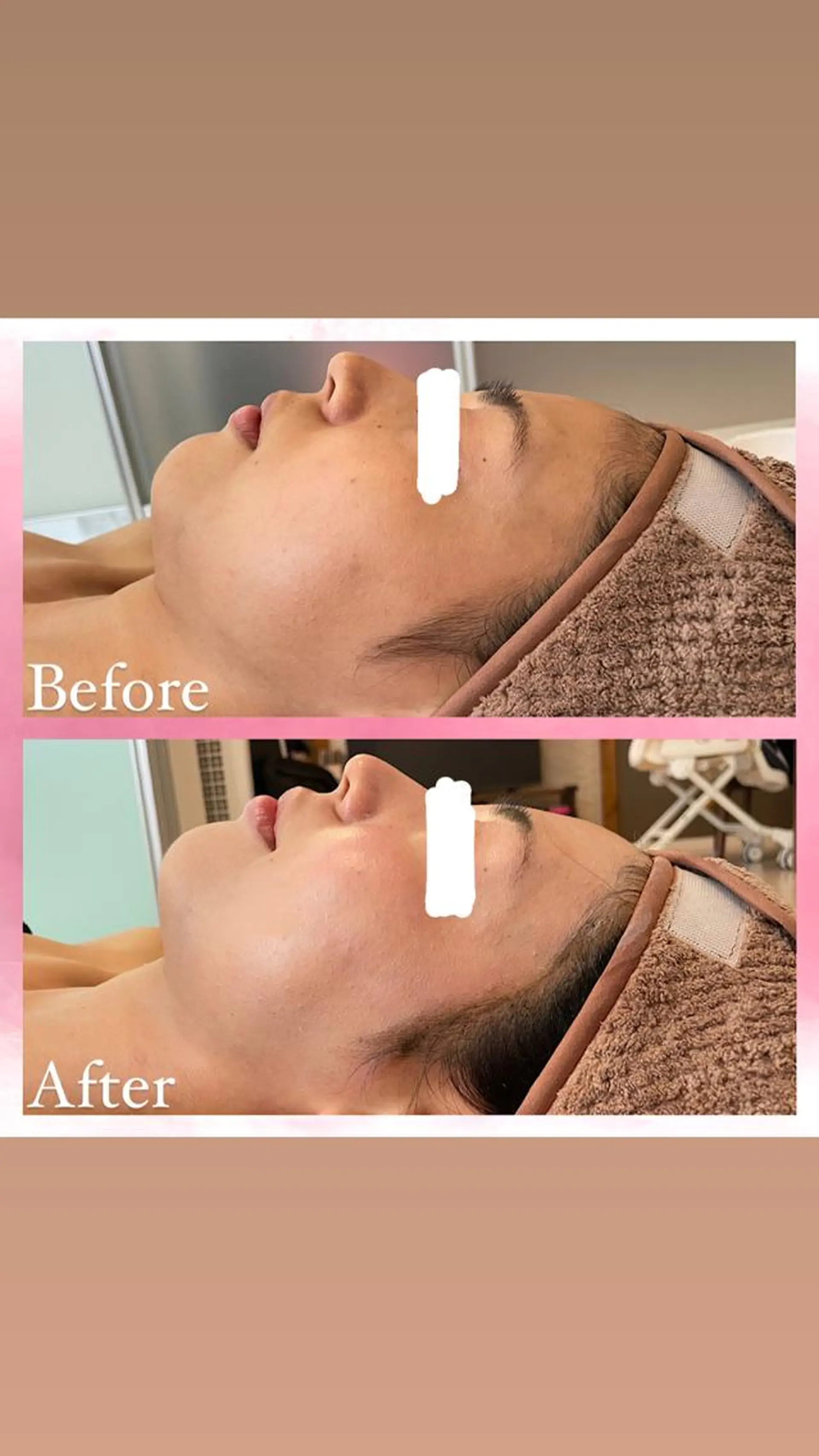 エステ salon〜RePCa〜(サロンルピカ)所属・山﨑 藍のエステ・リラクイメージ