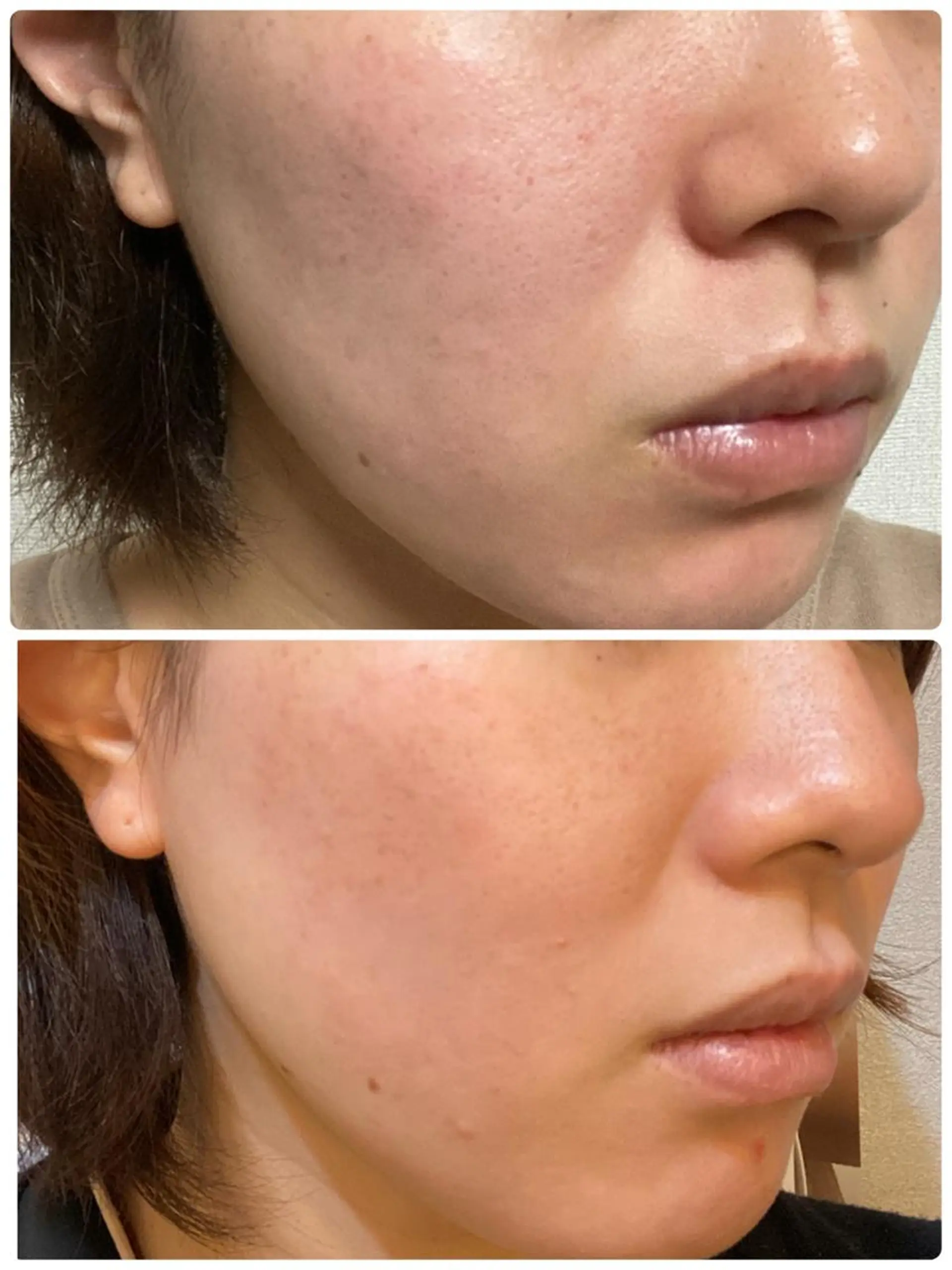 メンズ 男女同額完全個室脱毛 LEPIA内田のエステ・リラクイメージ