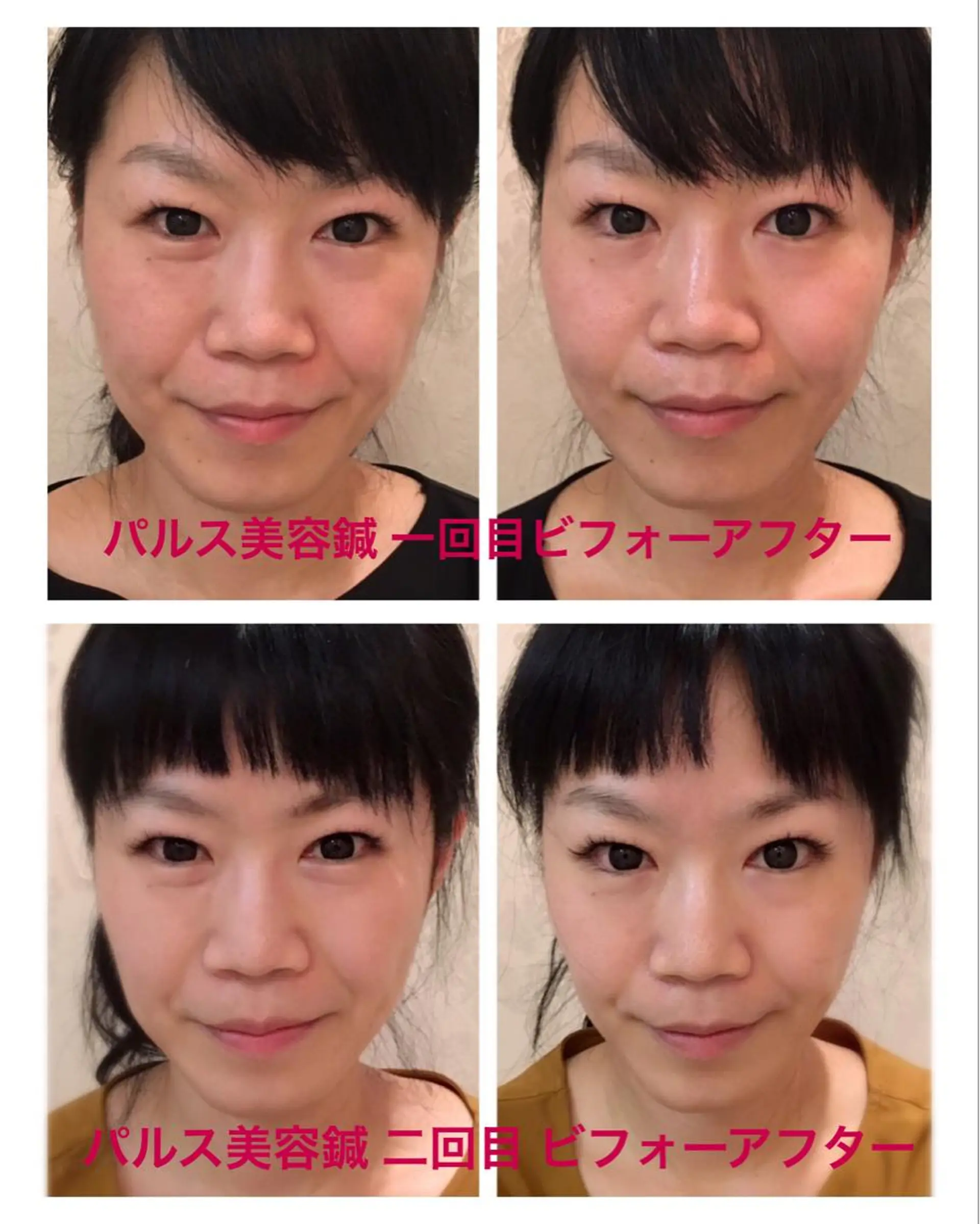 美容鍼サロン    Fleurir所属・伊藤 かなえのエステ・リラクイメージ