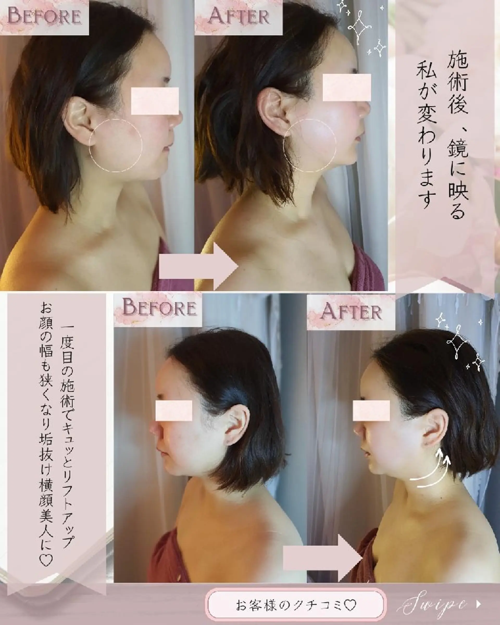 痩身ハーブピーリング 筋膜リリース☆B&Hのエステ・リラクイメージ