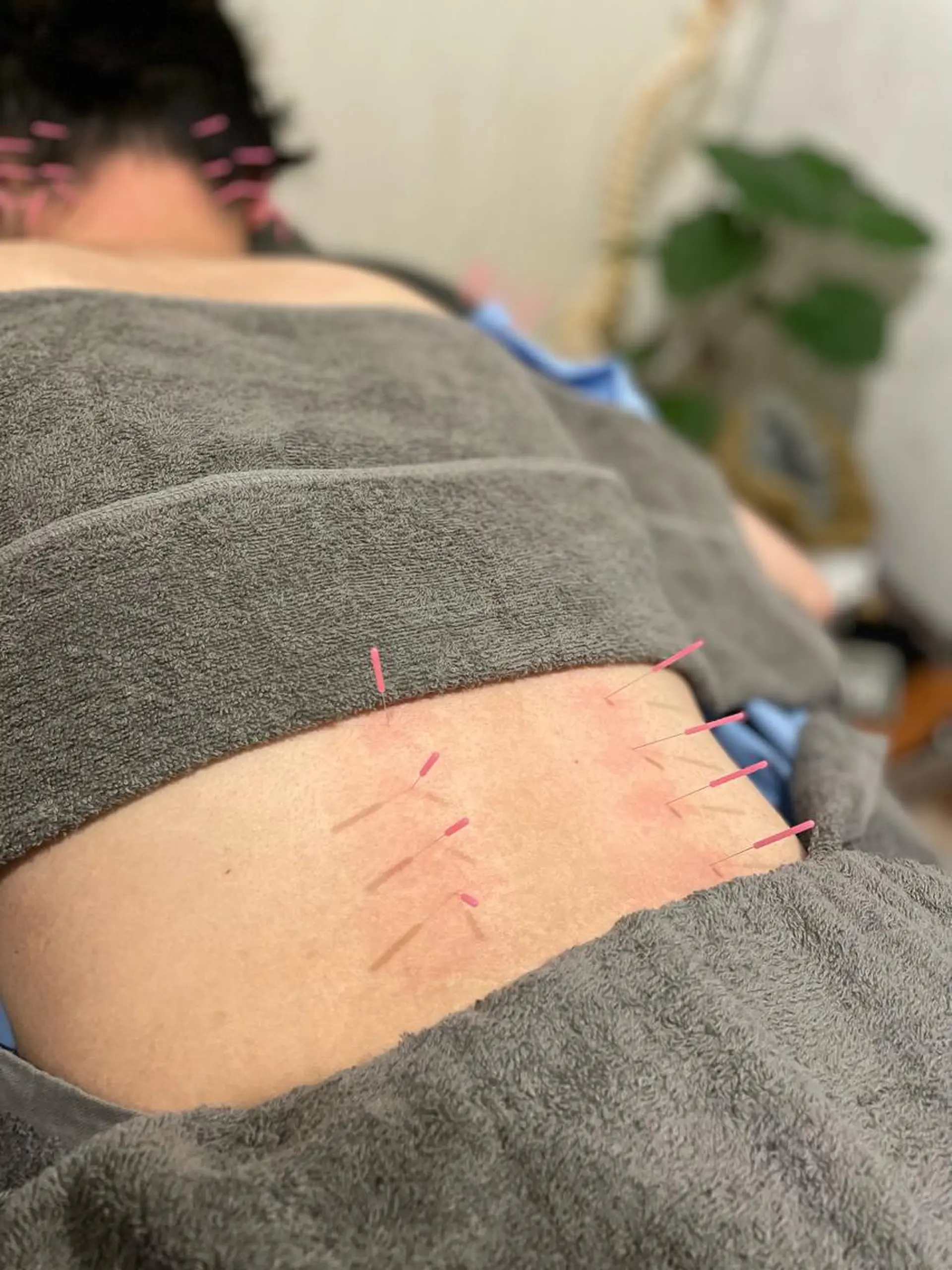 鍼・マッサージ 吉村治療院のエステ・リラクイメージ