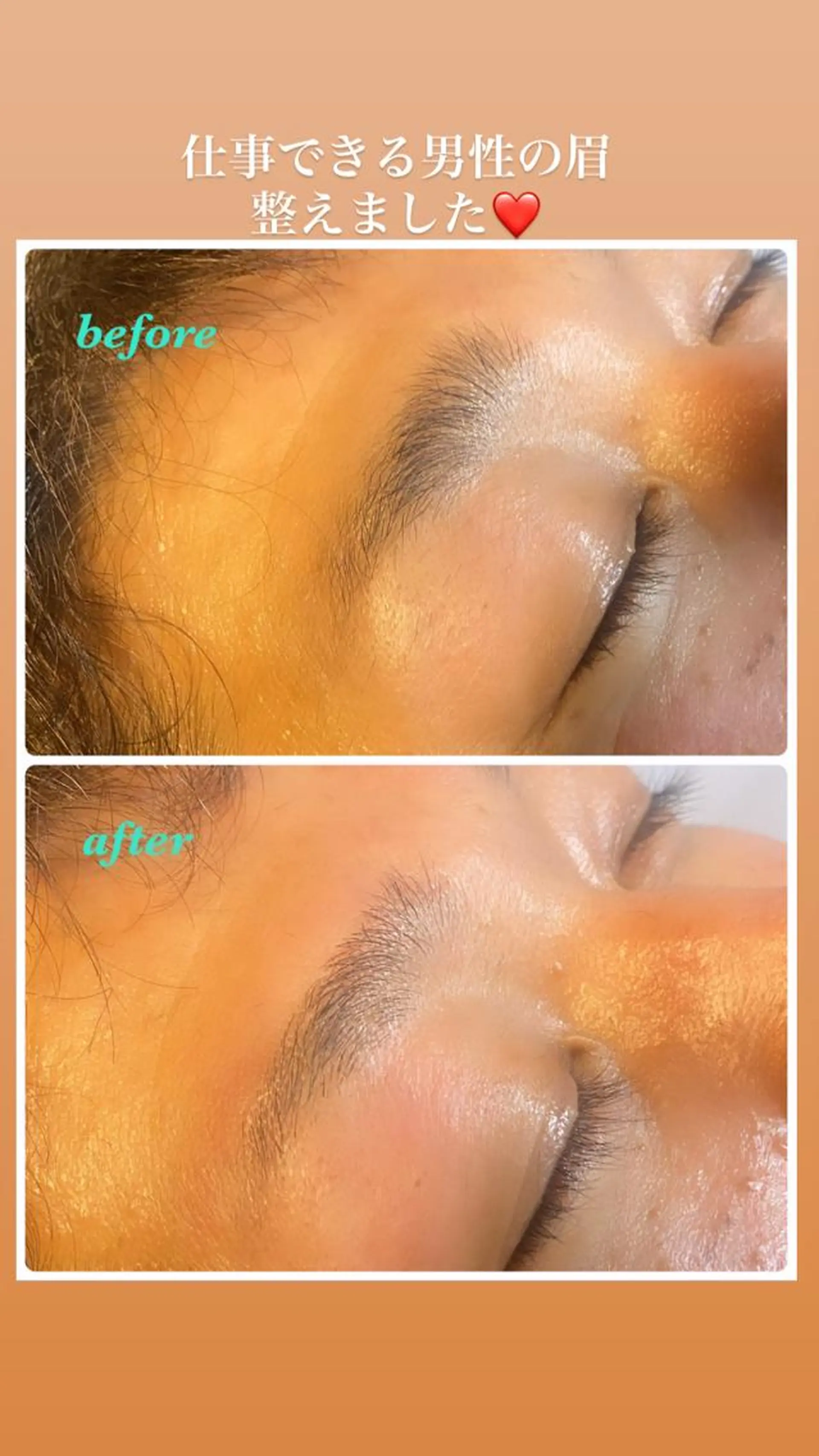 アイブロウ ハーブピーリング/韓国肌管理/フェイシャル/毛穴洗浄/眉毛/顔脱毛【糸脱毛専門】rev所属・ハーブピーリング🌹 毛穴洗浄❤️眉waxのエステ・リラクイメージ