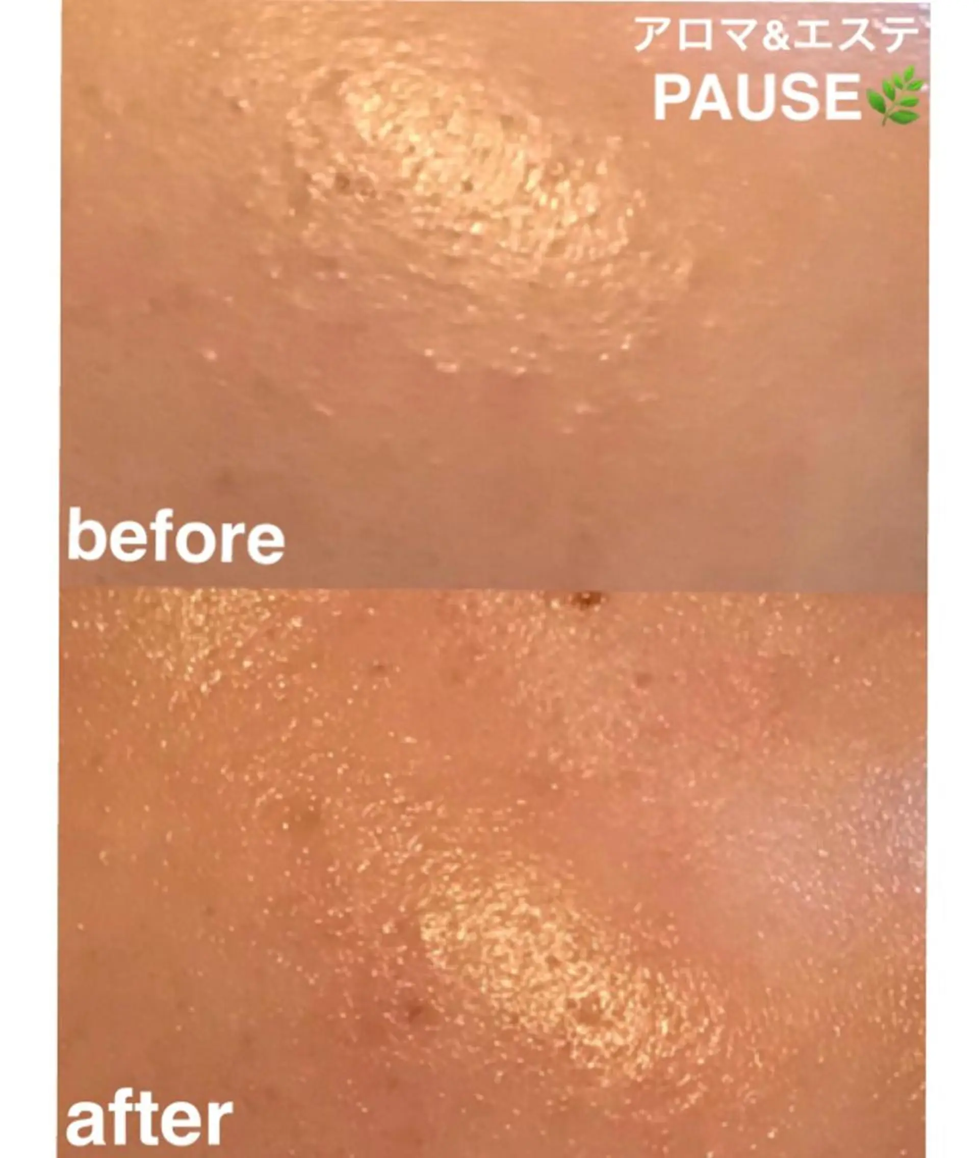 エステ 浜野 恵美のエステ・リラクイメージ