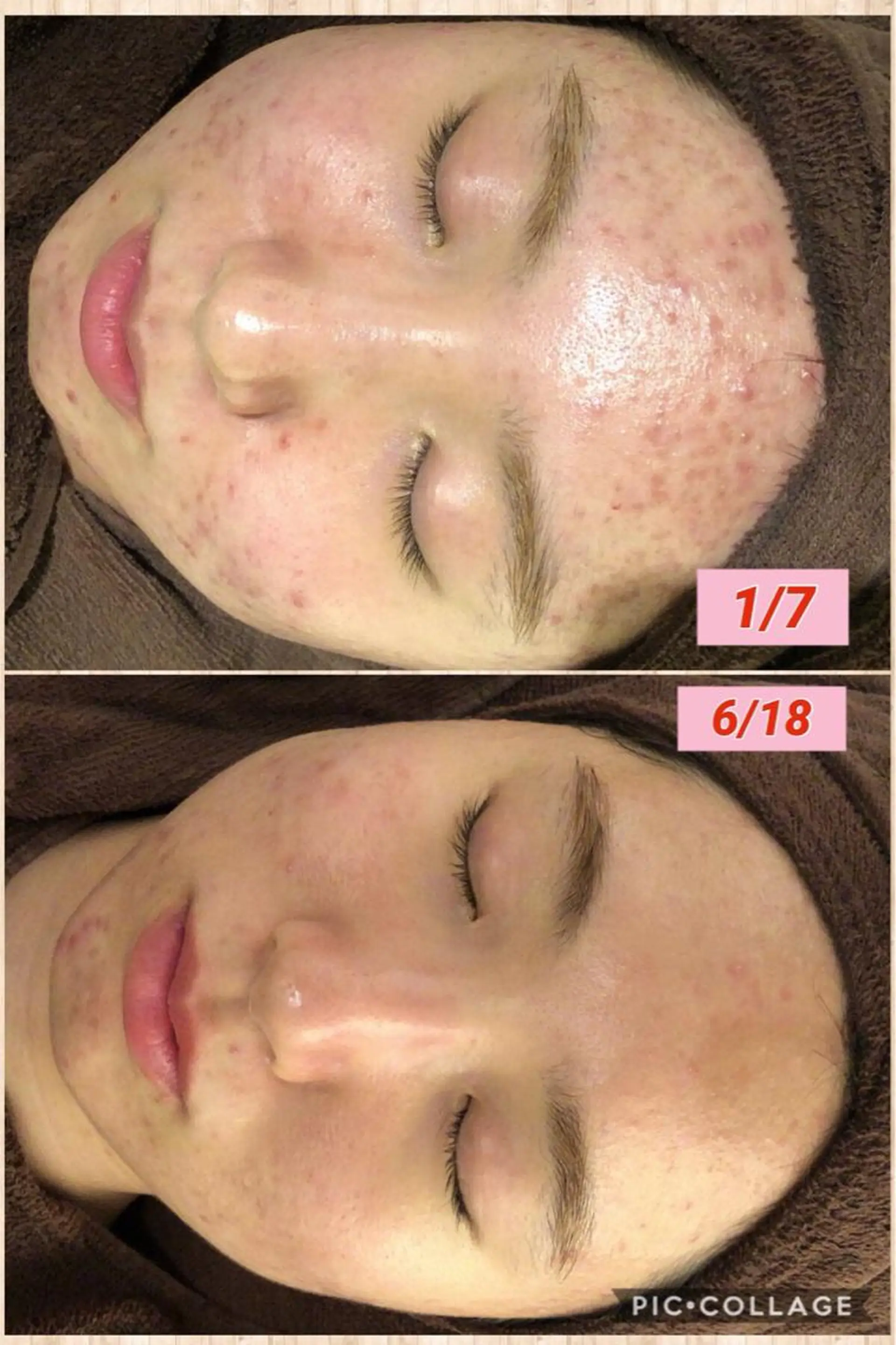 カラー パーマ ヘアアレンジ メンズ キッズ ネイル マツエク・マツパ 四つ星サロン🎖 腸＆ニキビケアに特化のエステ・リラクイメージ