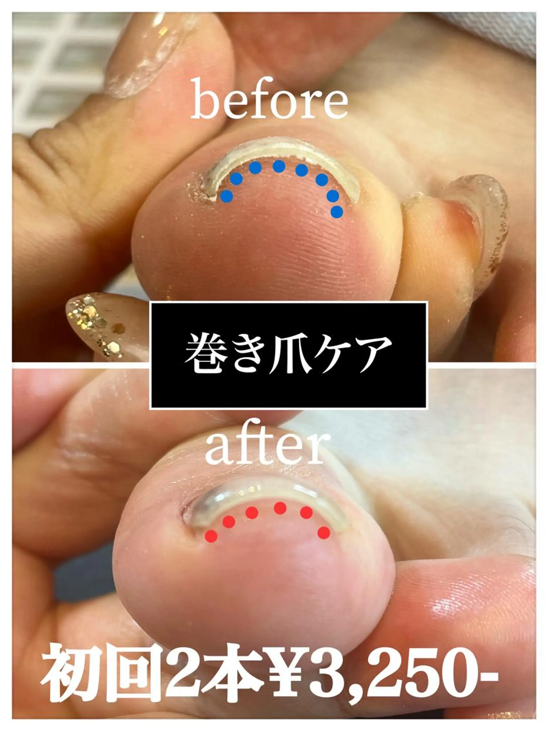 ネイル フットネイル フットネイル ａｈｉｒｕｎｏ ✿ ｙｕiのネイルデザイン