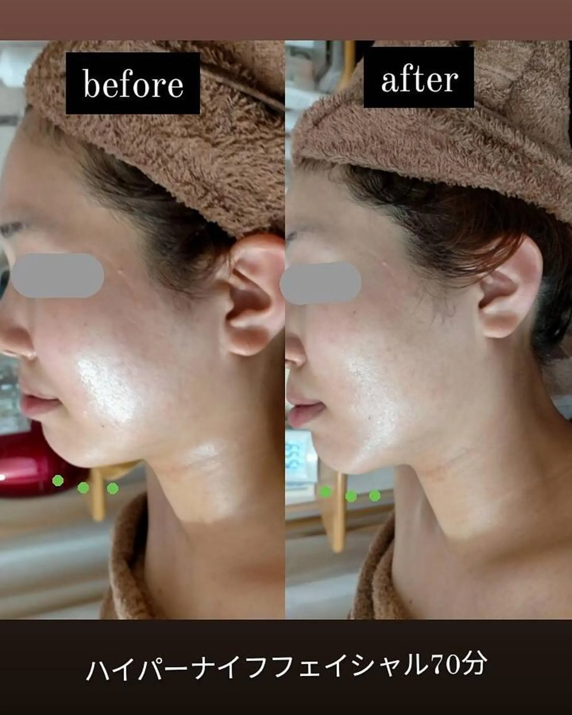 km retreat mentのエステ・リラクイメージ