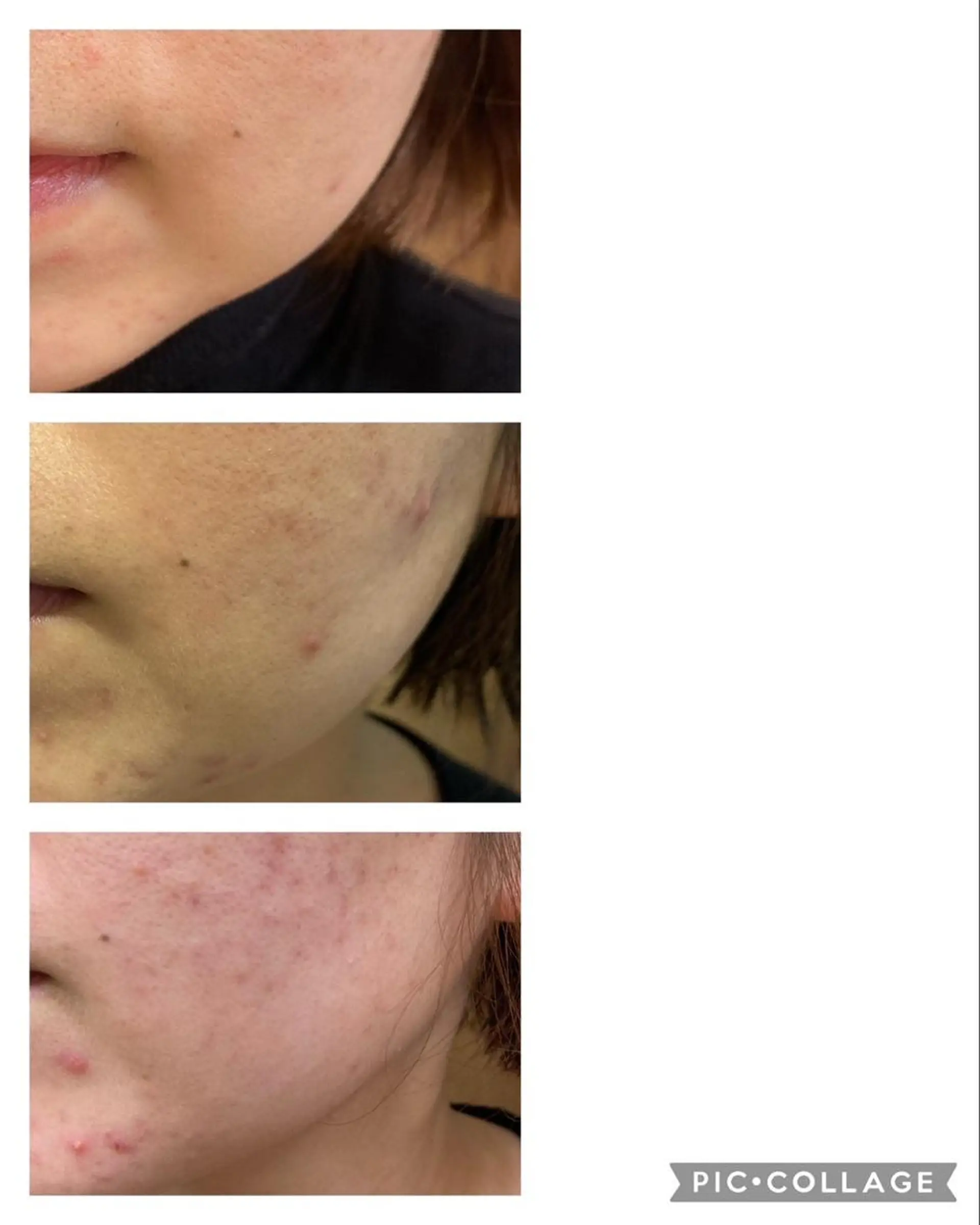 hair&spa tonchi所属・Esthetic MANAMIのエステ・リラクイメージ