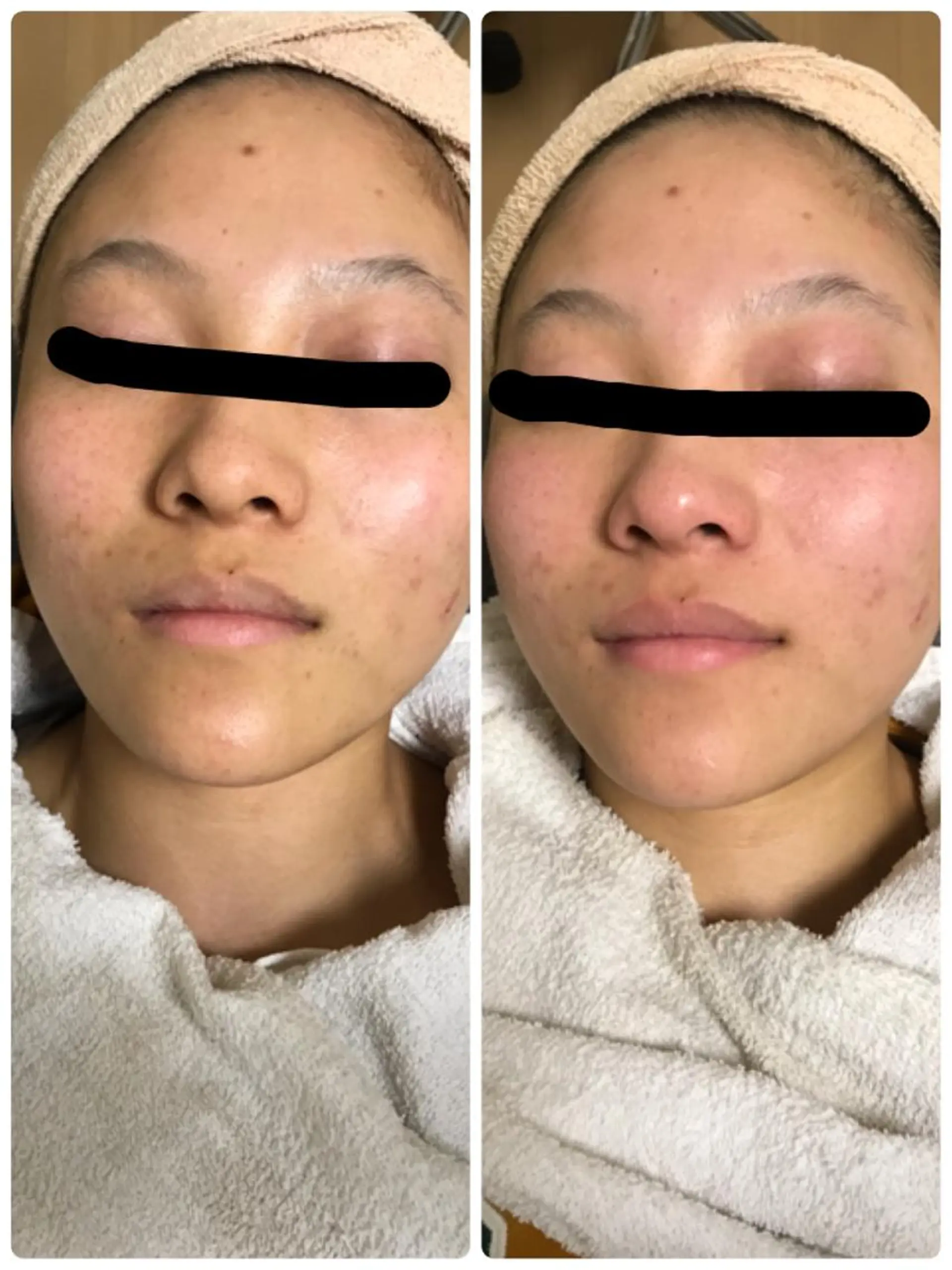 トータルエステサロン Tiaraのエステ・リラクイメージ