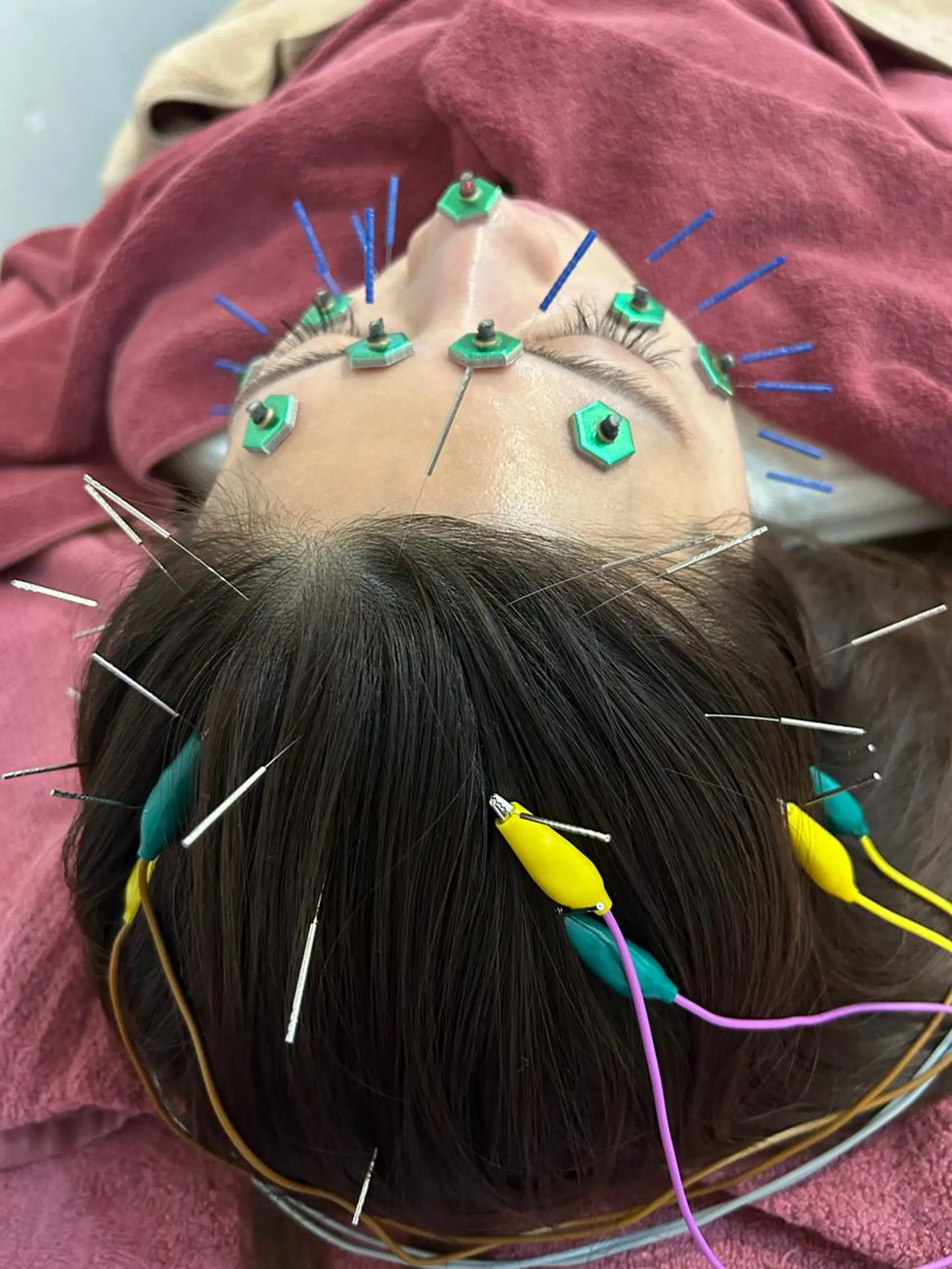 エステ リラク 美容鍼灸女性専用 りんご鍼灸治療院のその他イメージ