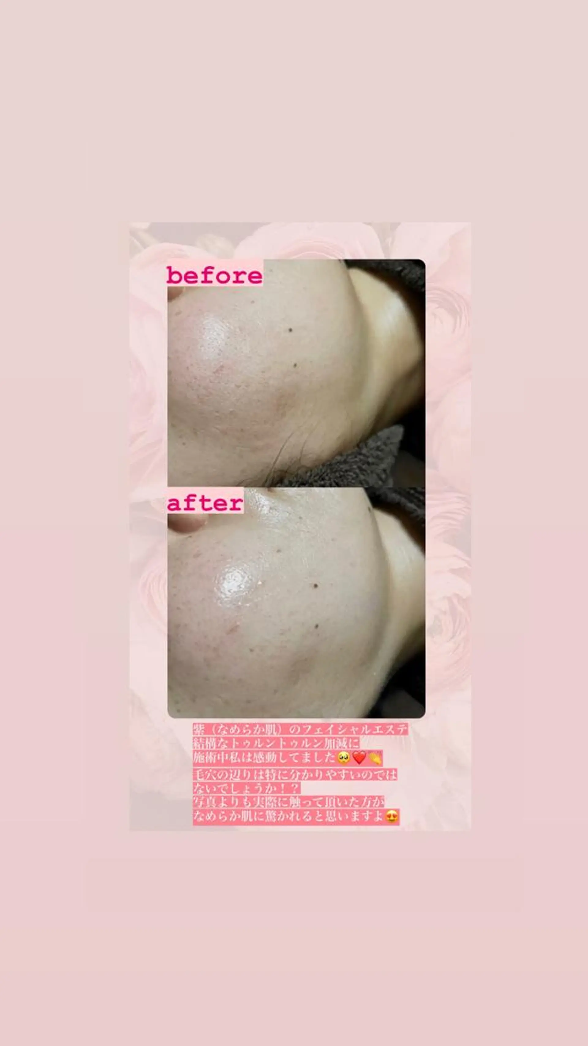 アイカワールド所属・鈴木 愛加のエステ・リラクイメージ