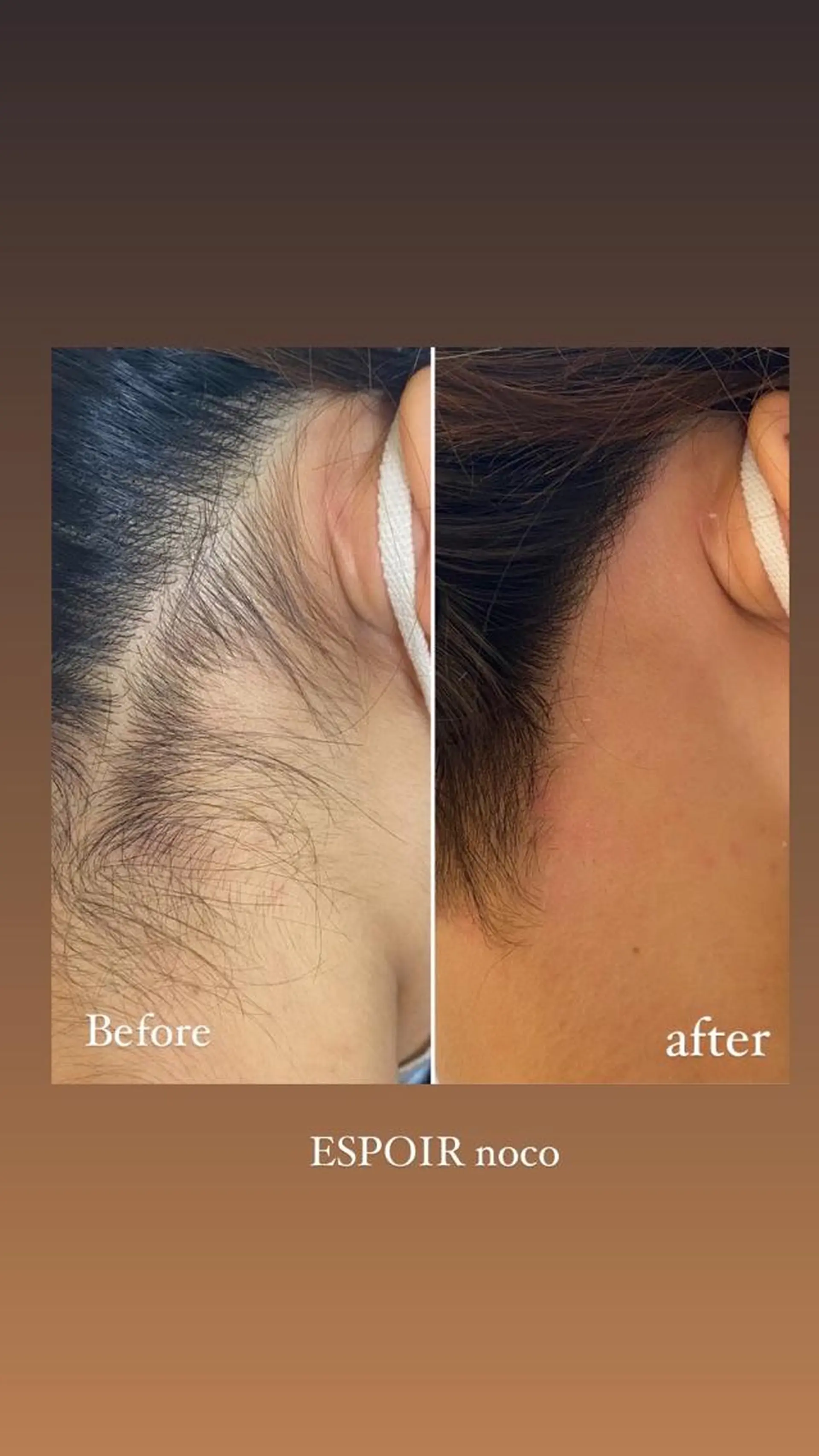 ワックス脱毛🌈 ESPOIRnocoのエステ・リラクイメージ