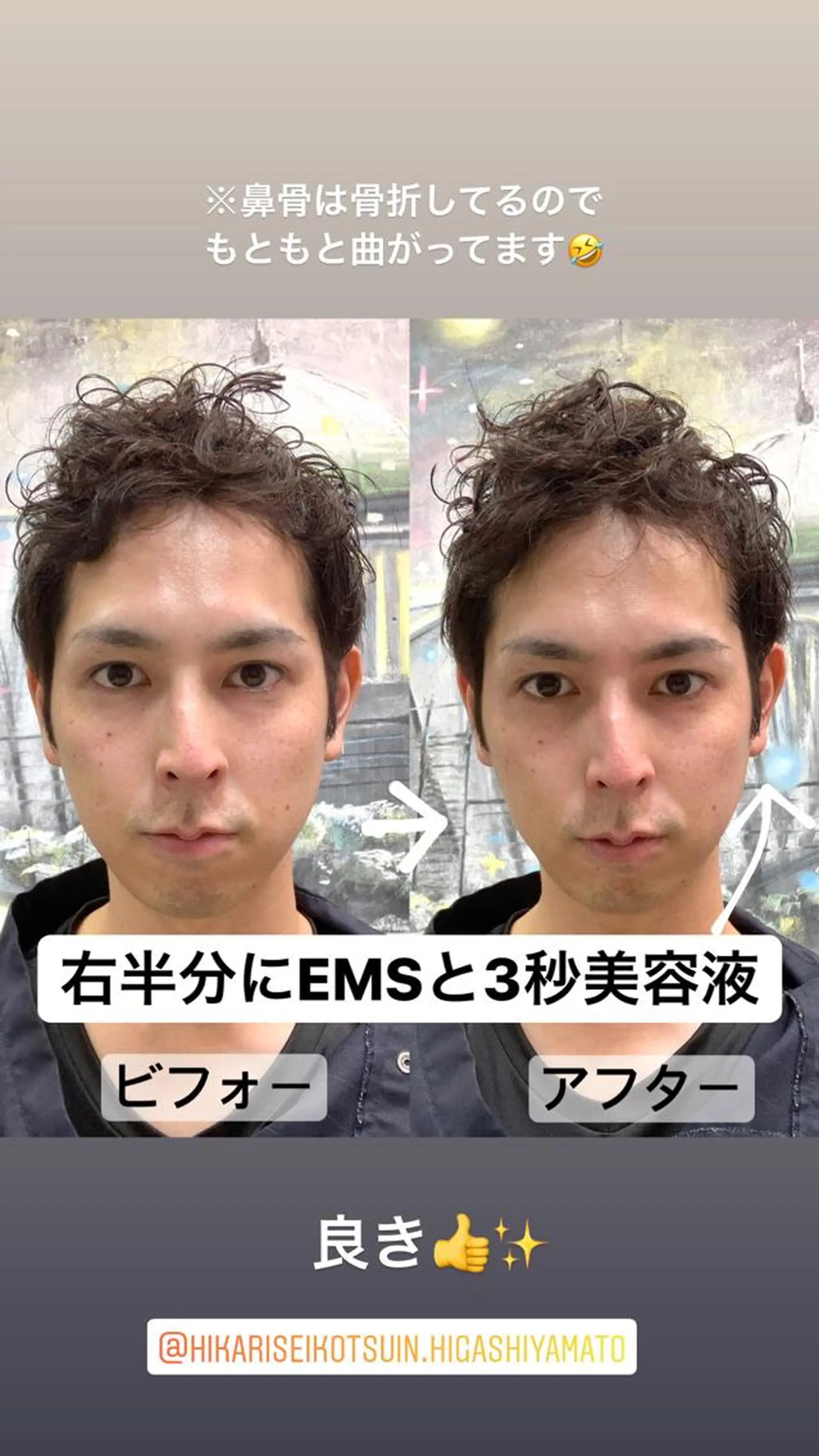 小顔矯正/美容整体 /骨盤矯正✨+Mi2のエステ・リラクイメージ