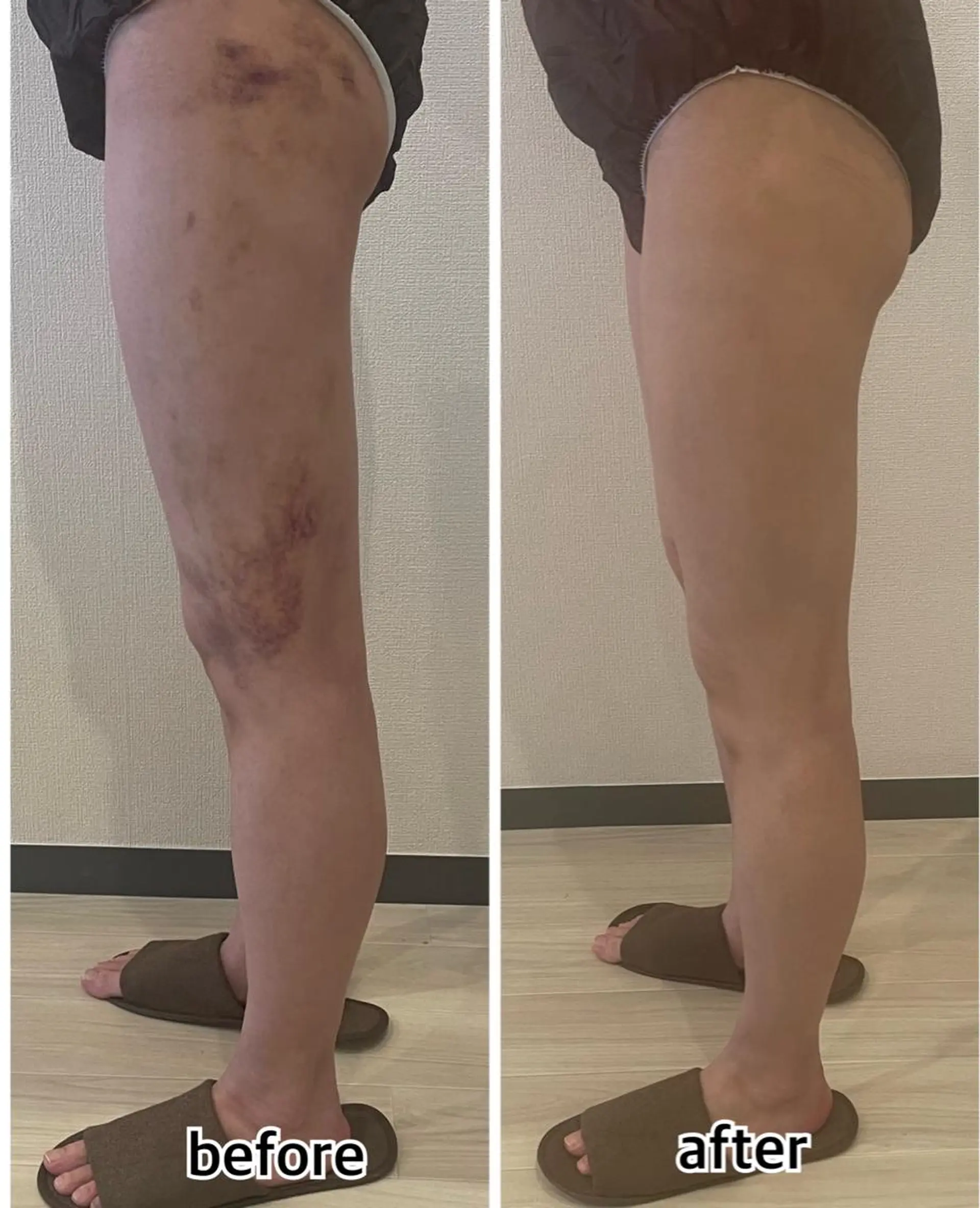 💎インディバ GEM💎indiba healing room GEM所属・💎 GEM💎のエステ・リラクイメージ