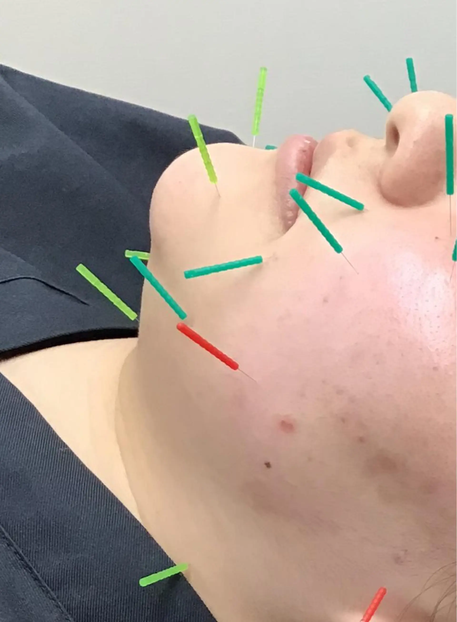 エステ リラク まごころ鍼灸整骨院所属・まごころ鍼灸整骨院 京王堀之内院のエステ・リラクイメージ