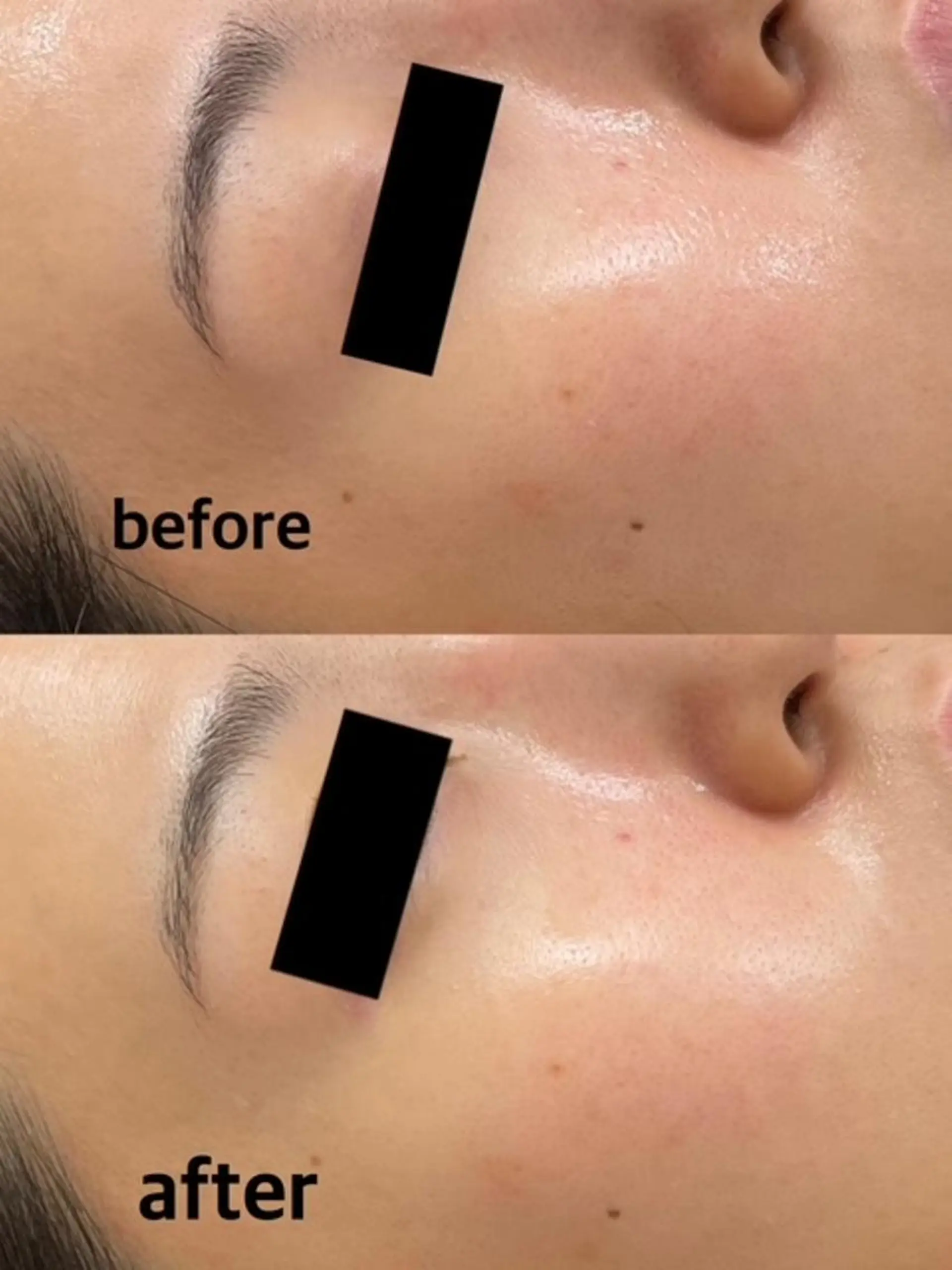 肌ケア＆毛穴洗浄 Cheriのエステ・リラクイメージ