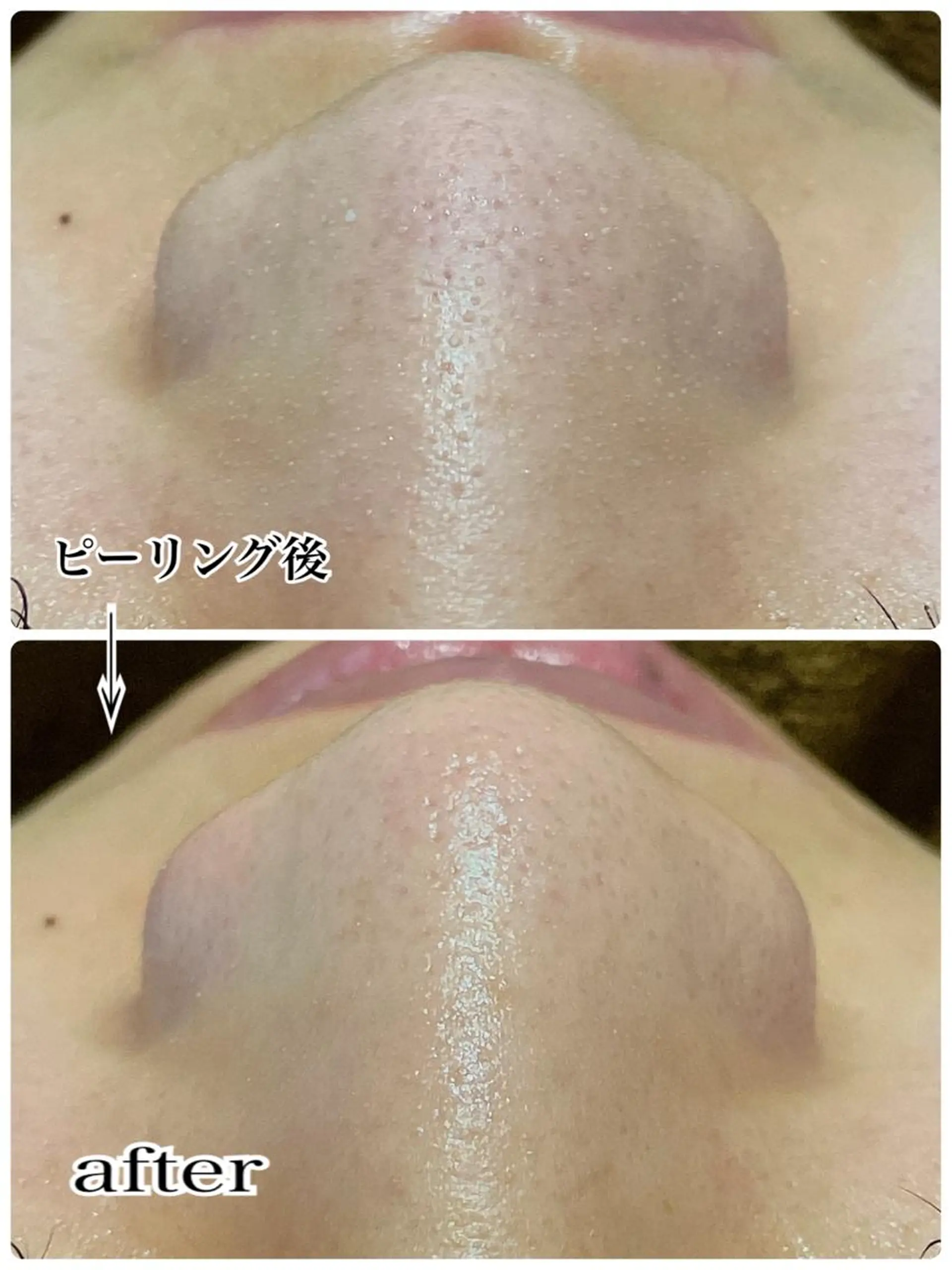 ENCHANT 脱毛.小顔.毛穴のエステ・リラクイメージ