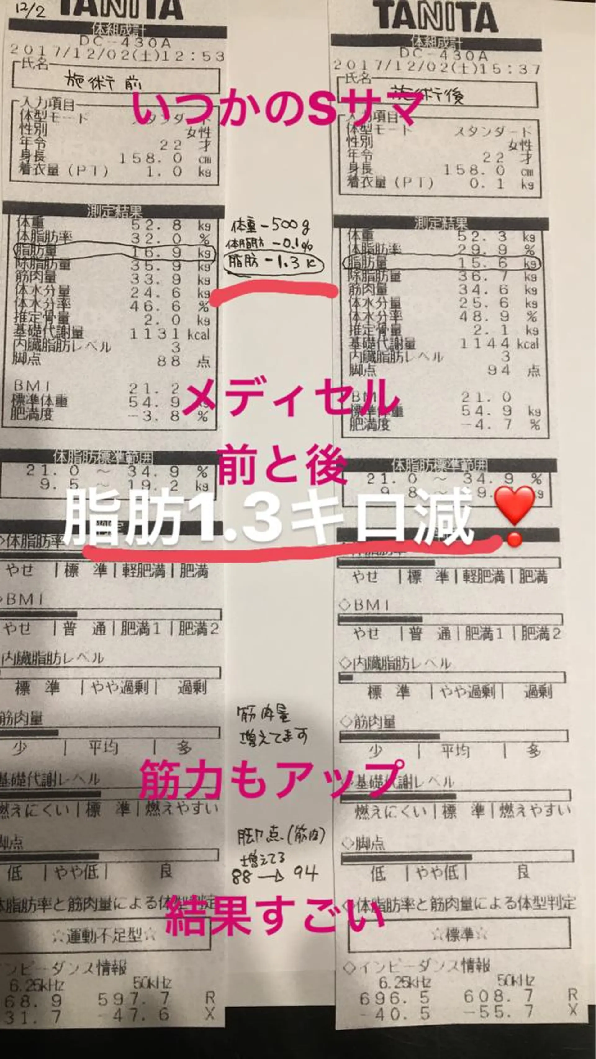 エステ リラク 隠れ家サロン〜MIYU〜所属・うすき隠れ家サロン MIYUのその他イメージ