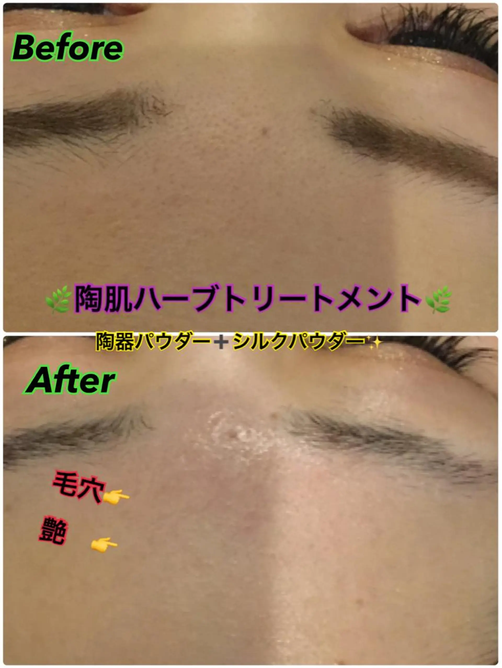 エステ 【リベルハーブピーリング認定店】敏感肌・美白脱毛専門店Dione立川店所属・Dione 立川店のエステ・リラクイメージ