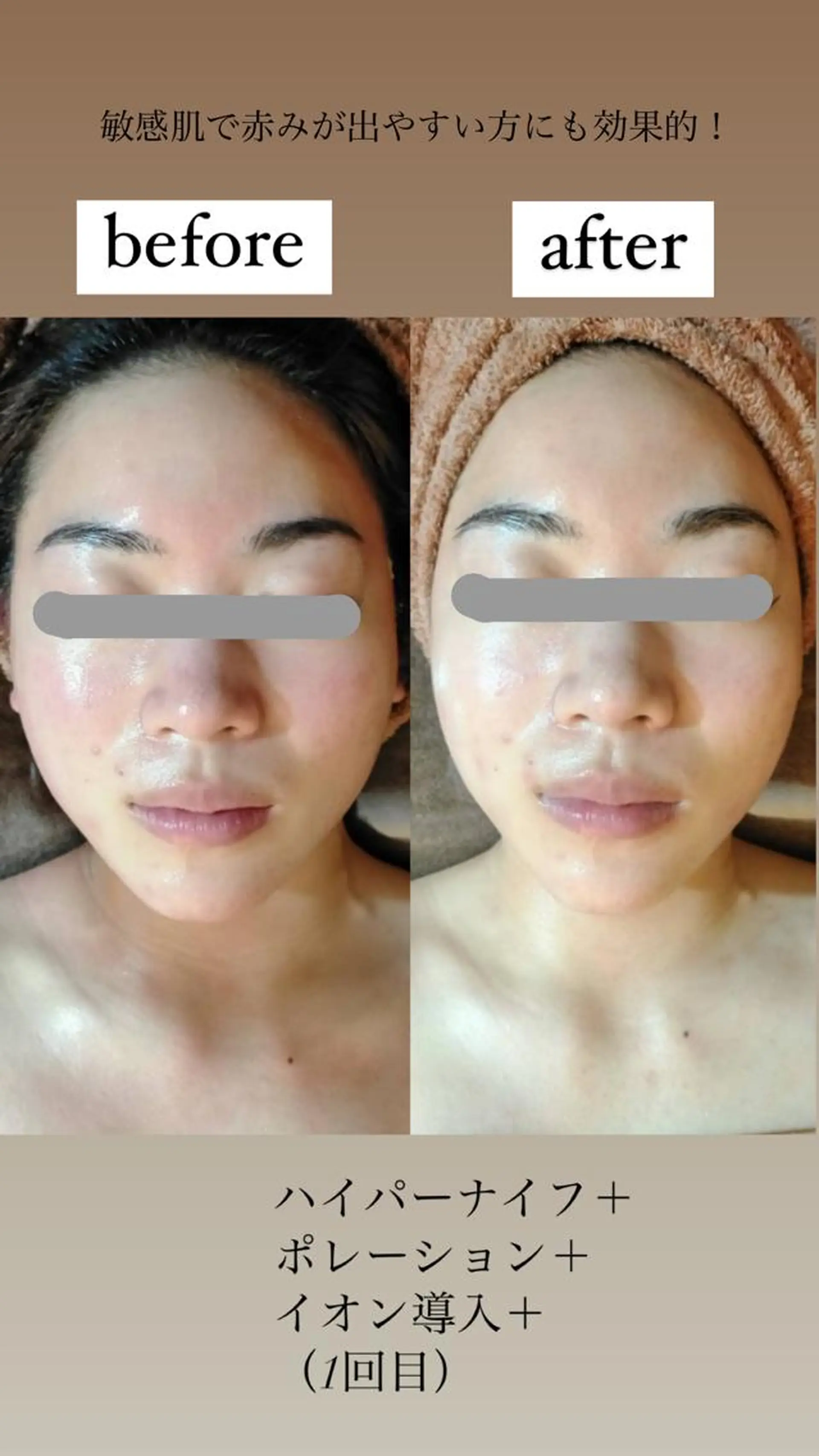 km retreat mentのエステ・リラクイメージ