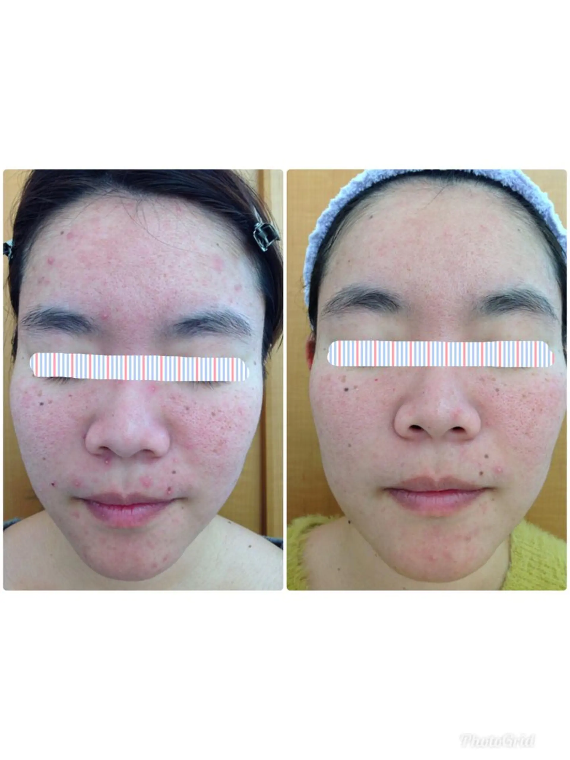 Facial stylist salon伊勢崎所属・中島 有希のエステ・リラクイメージ