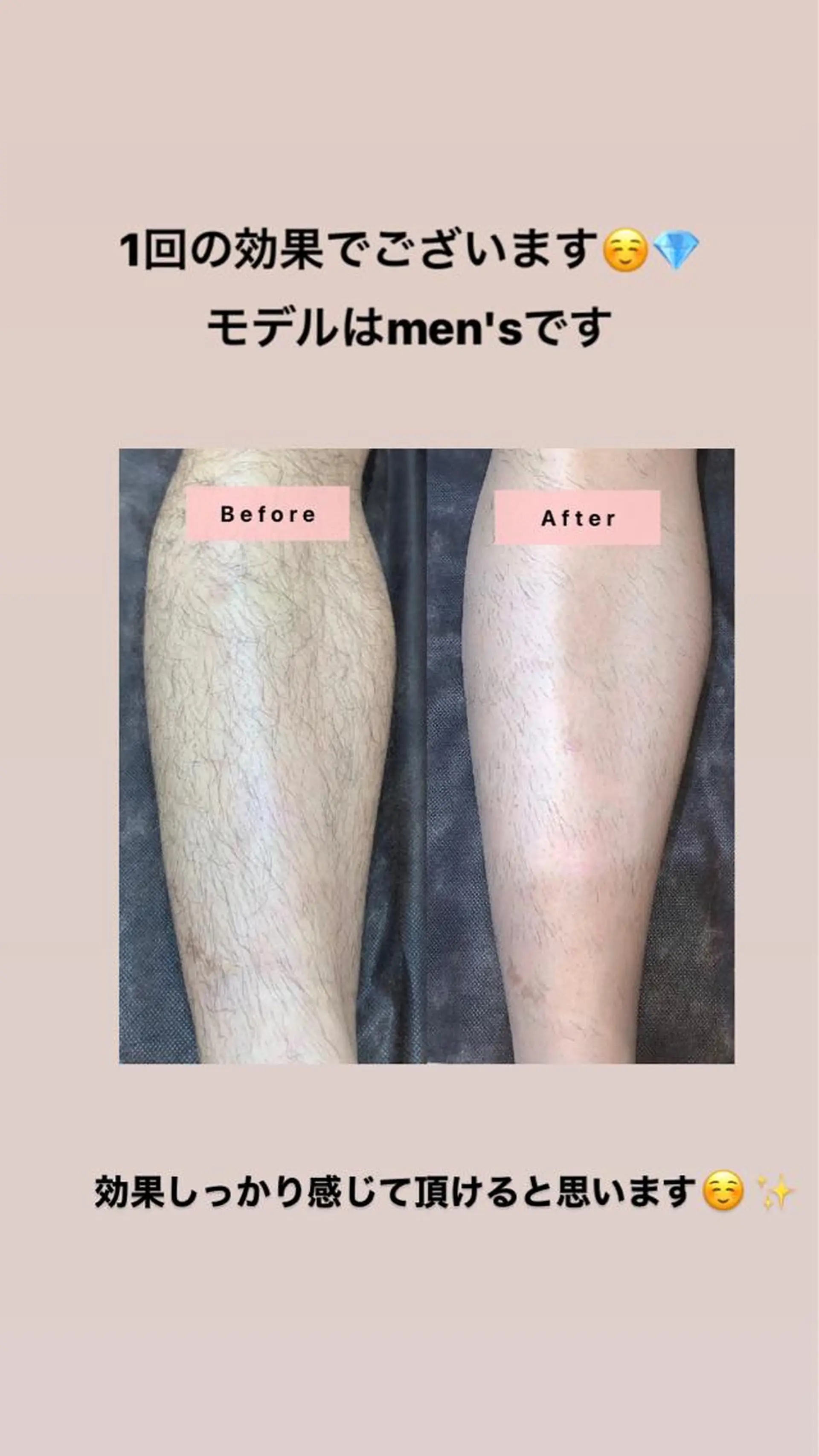 セミロング カラー パーマ ヘアアレンジ メンズ キッズ ネイル マツエク・マツパ Chloe-クロエ- 脱毛/フェイシャルのエステ・リラクイメージ