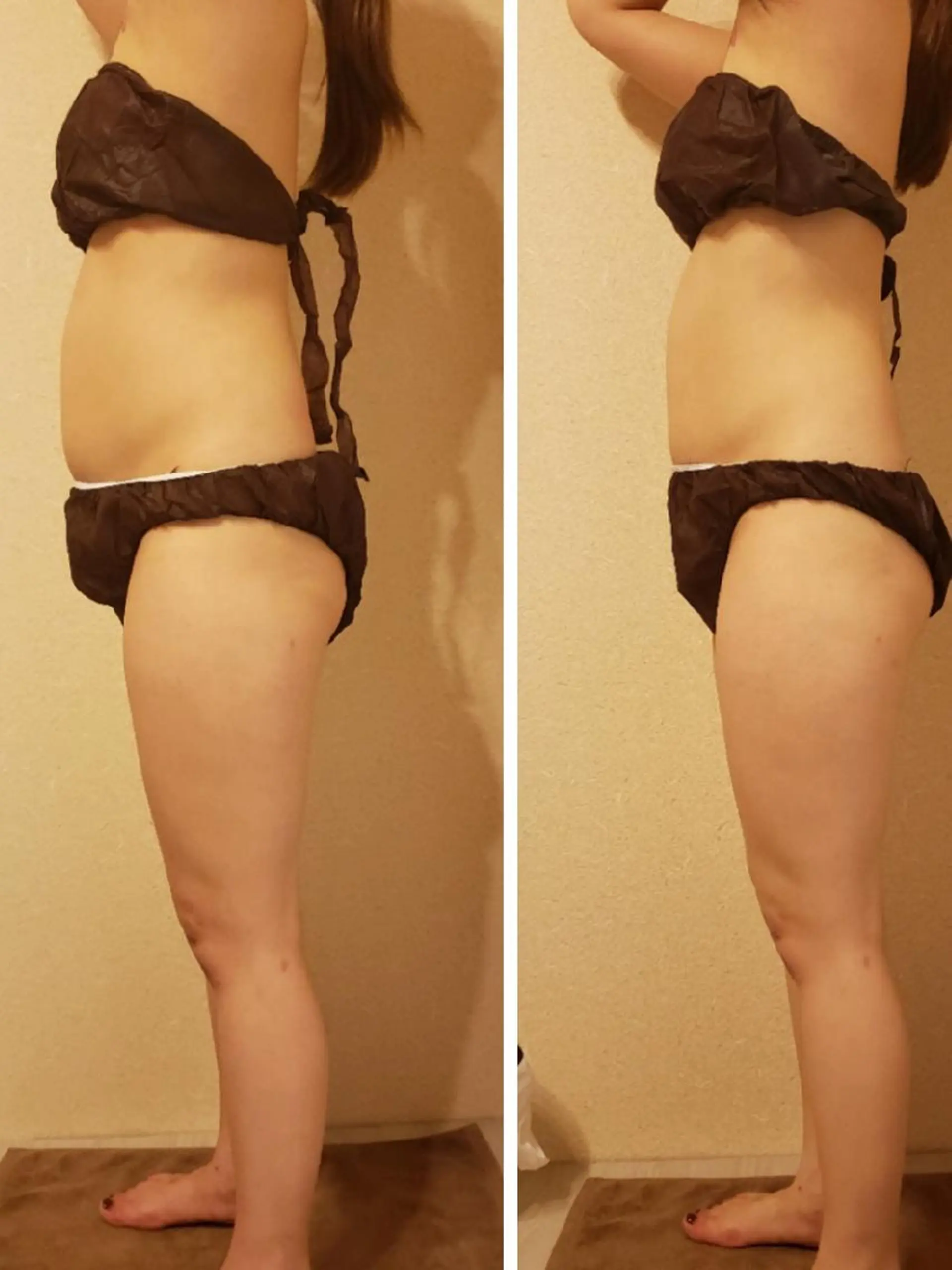 ロゼ ブランシュのエステ・リラクイメージ