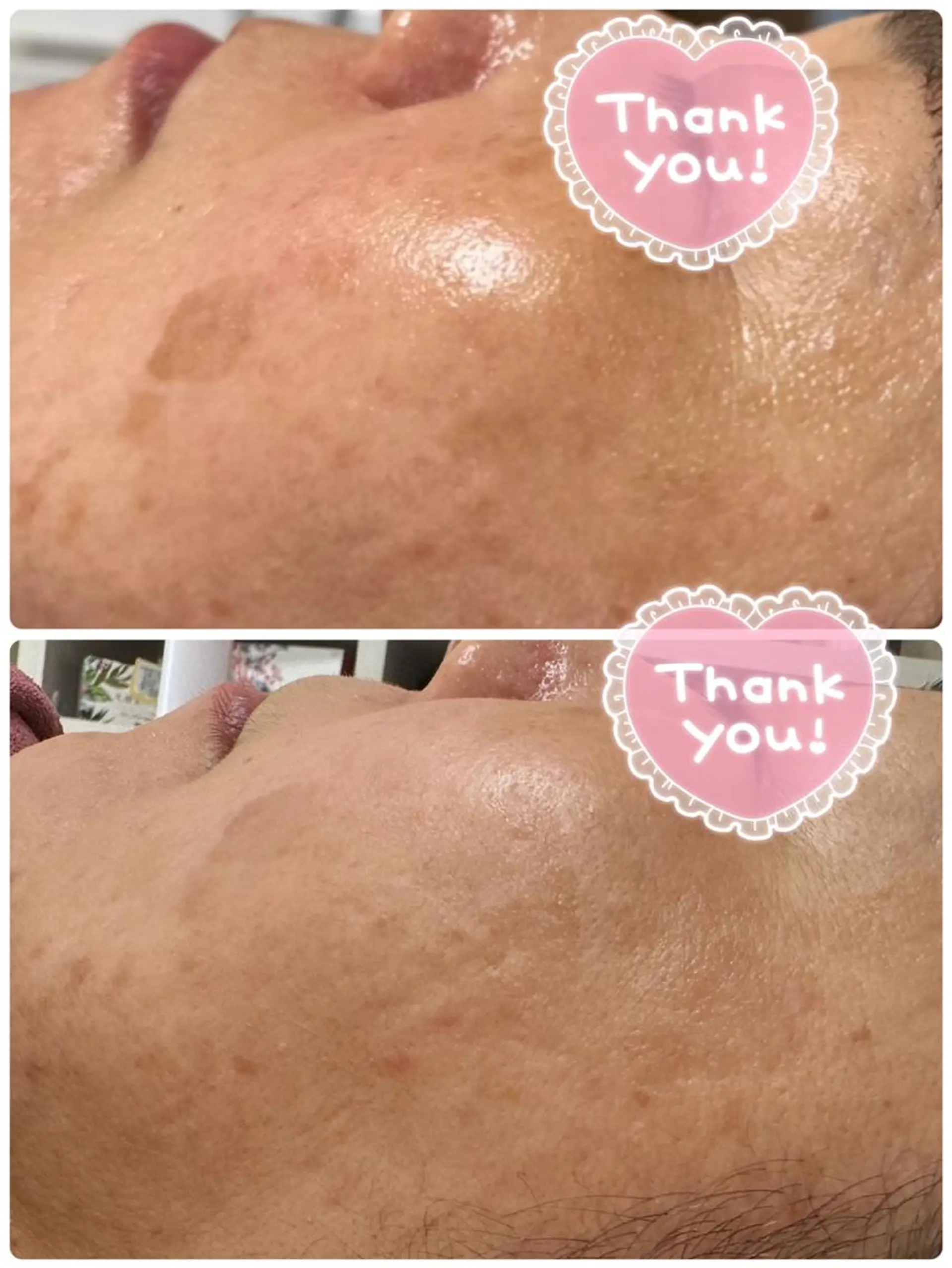 Lien オーナー 山口智嘉のエステ・リラクイメージ