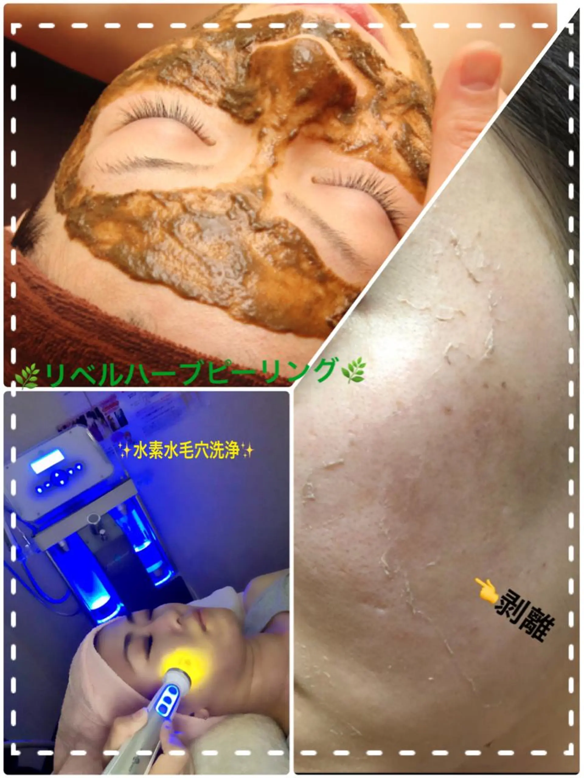 エステ 【リベルハーブピーリング認定店】敏感肌・美白脱毛専門店Dione立川店所属・Dione 立川店のエステ・リラクイメージ