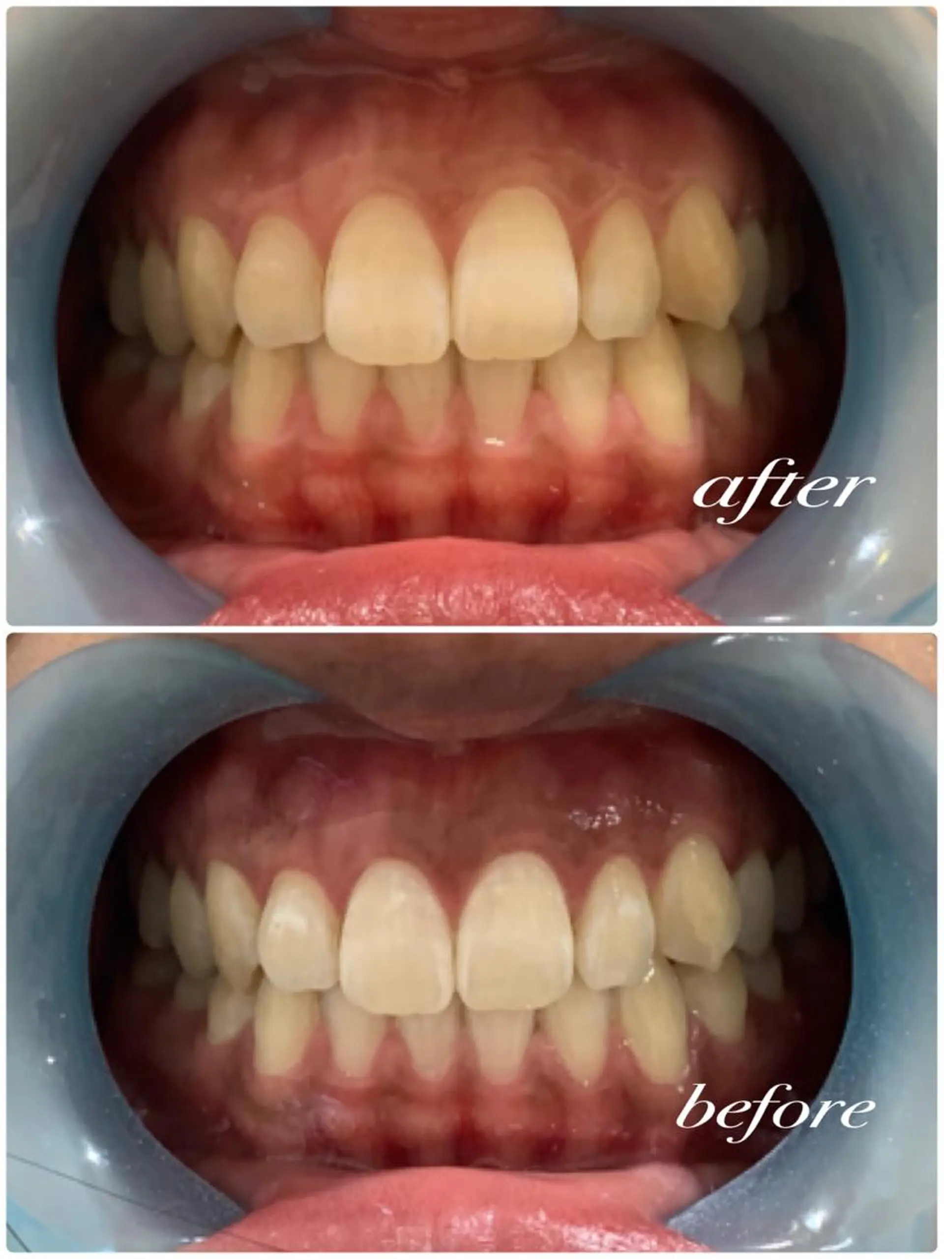 Whitening Diversのその他イメージ