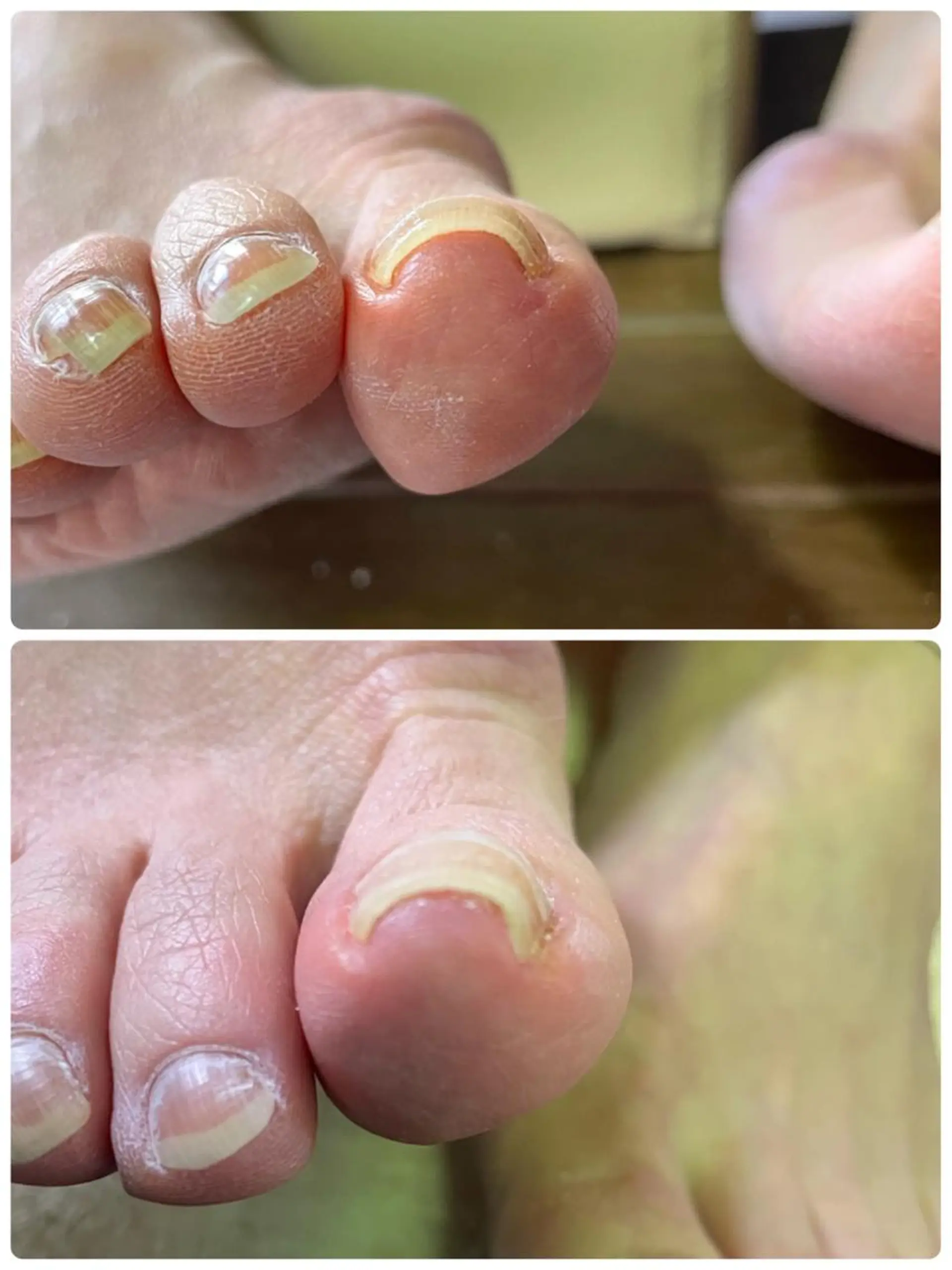 ネイル レワード所属・reward＊安藤 ゆかりのネイルデザイン