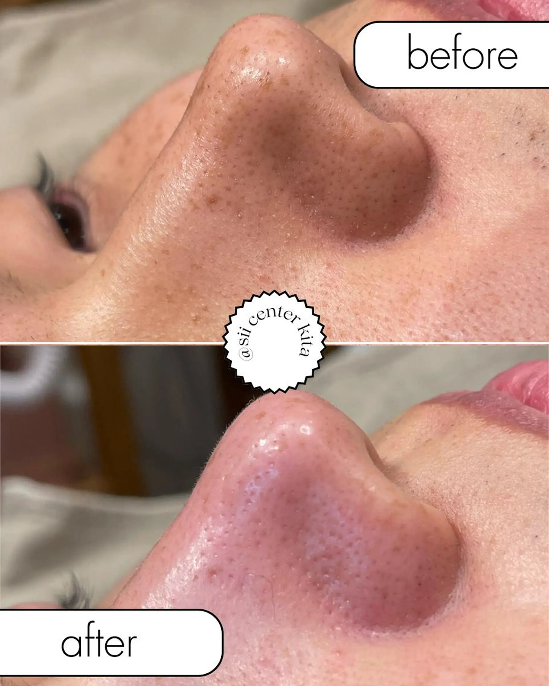 エステ sii MIUのエステ・リラクイメージ