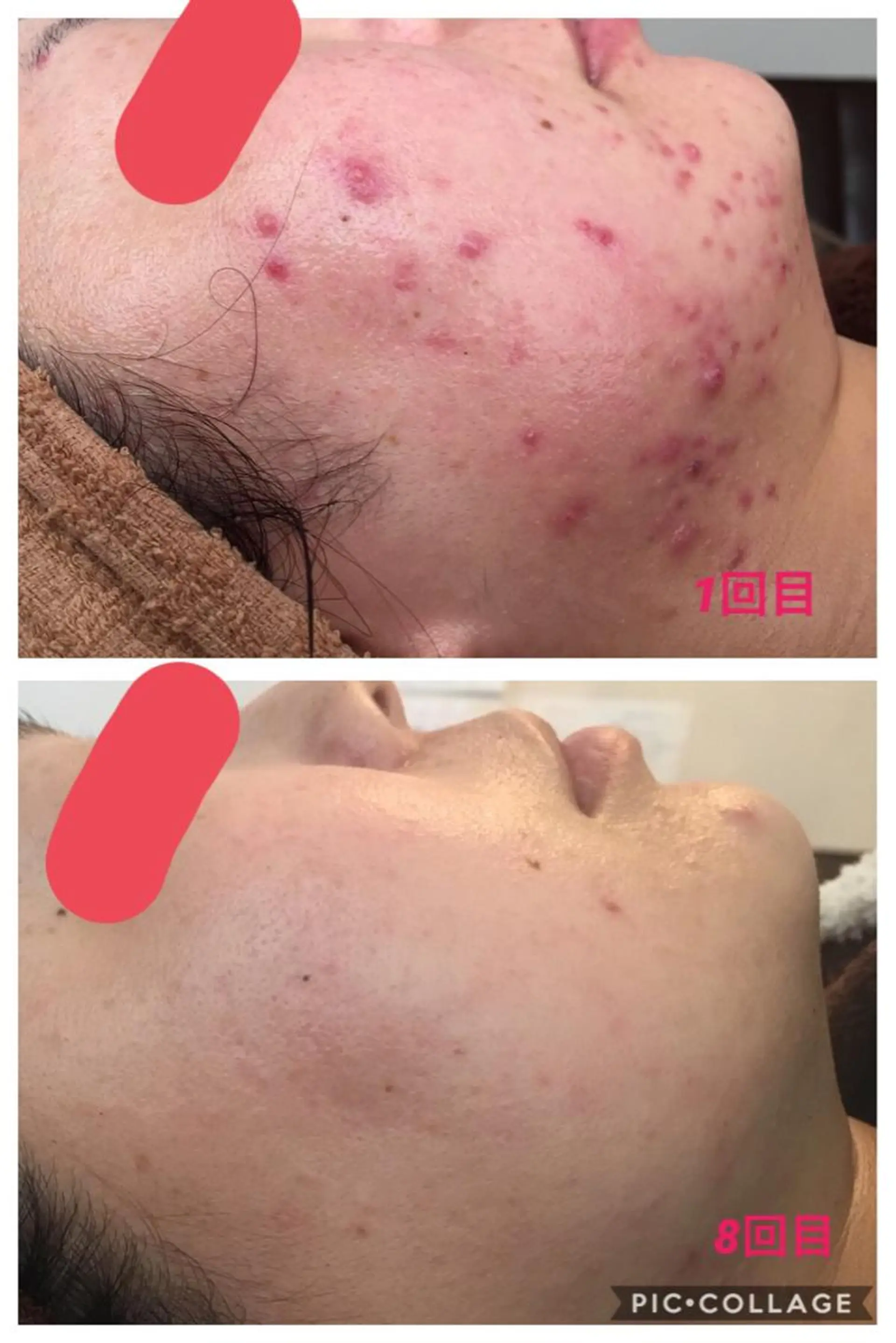 エステ 三島 美央のエステ・リラクイメージ