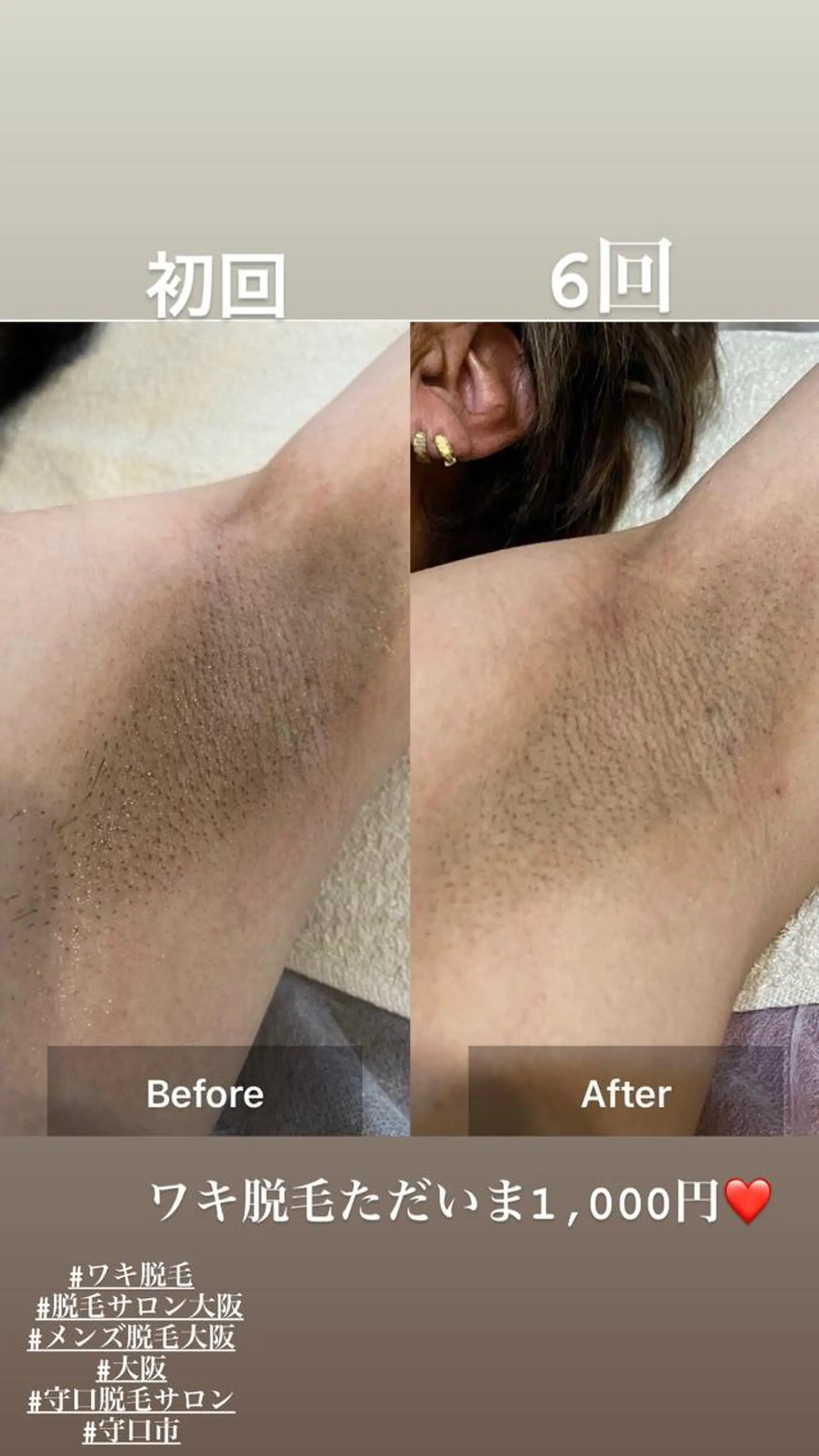 MARIRE EPISALONのエステ・リラクイメージ