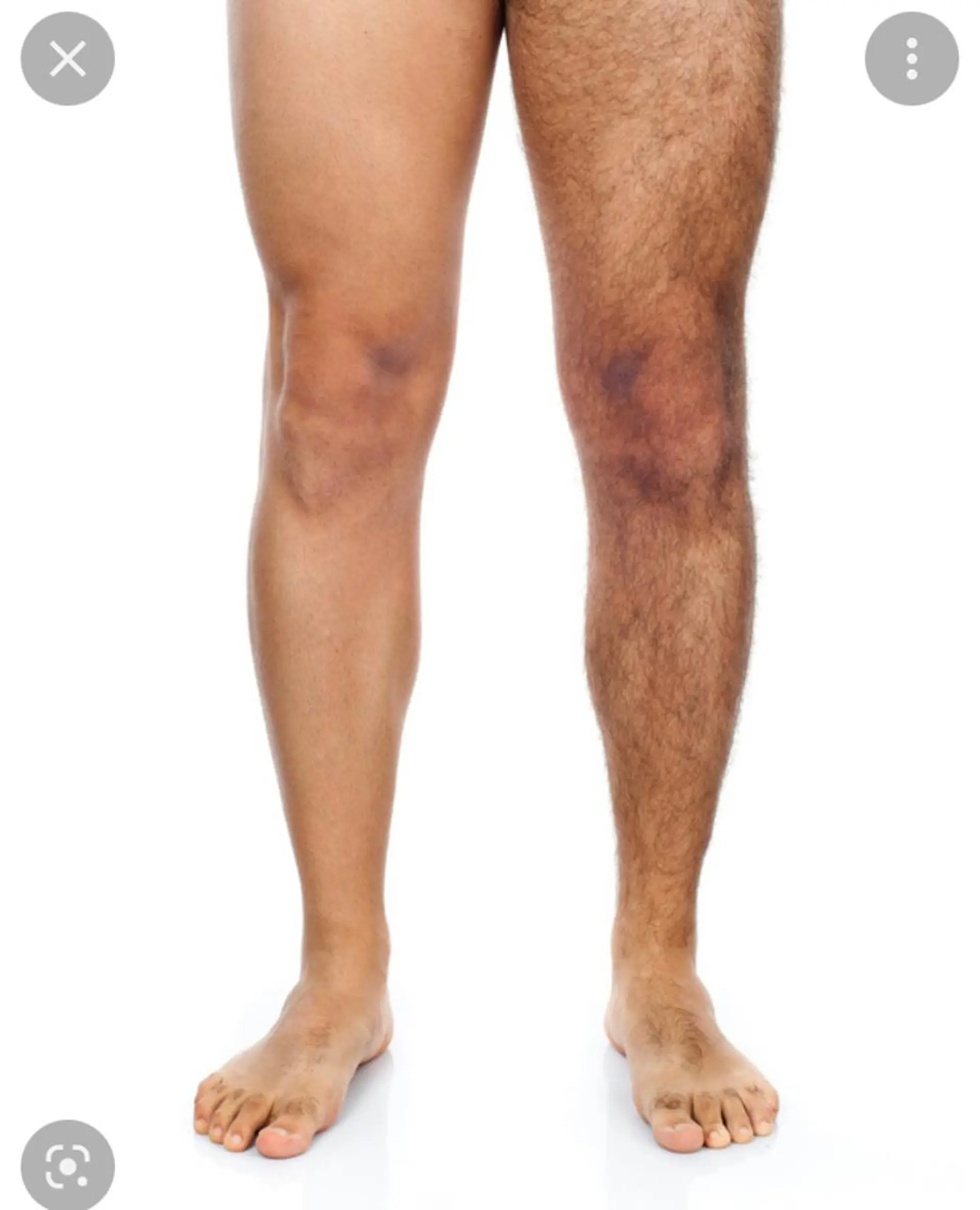 美肌脱毛サロン長居『K-epi』所属・【美肌専門サロン】 美肌脱毛K-epiのエステ・リラクイメージ